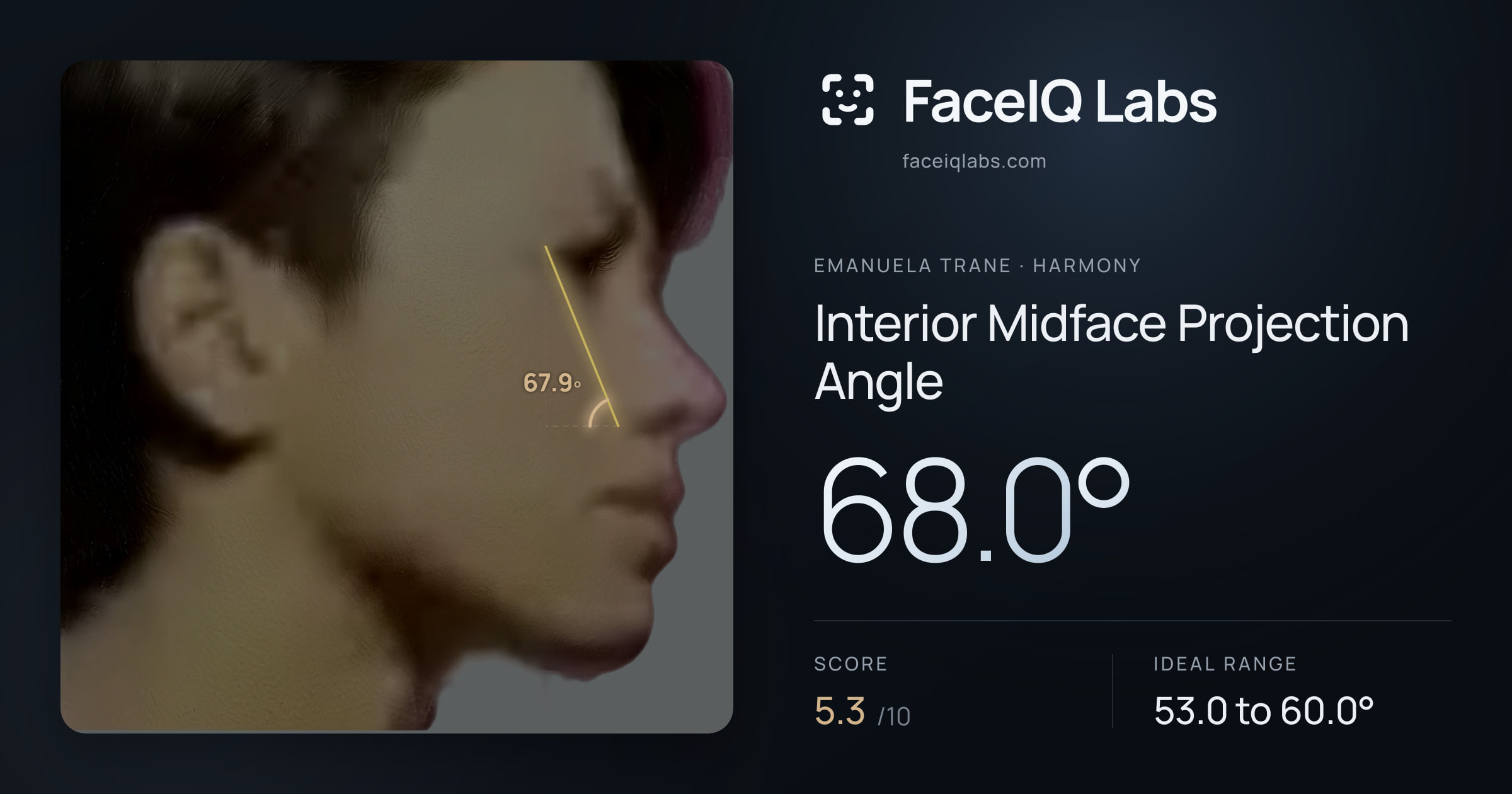 Emanuela Trane Interior Midface Projection Angle: 68.0°, drawn on the photo