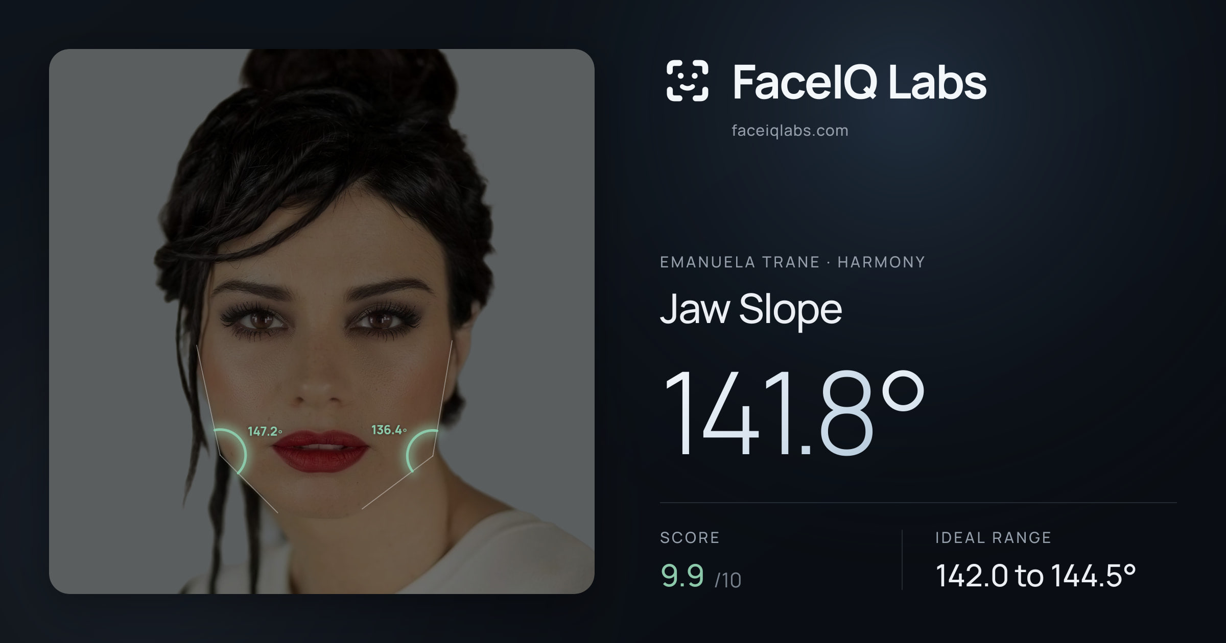 Emanuela Trane Jaw Slope: 141.8°, drawn on the photo