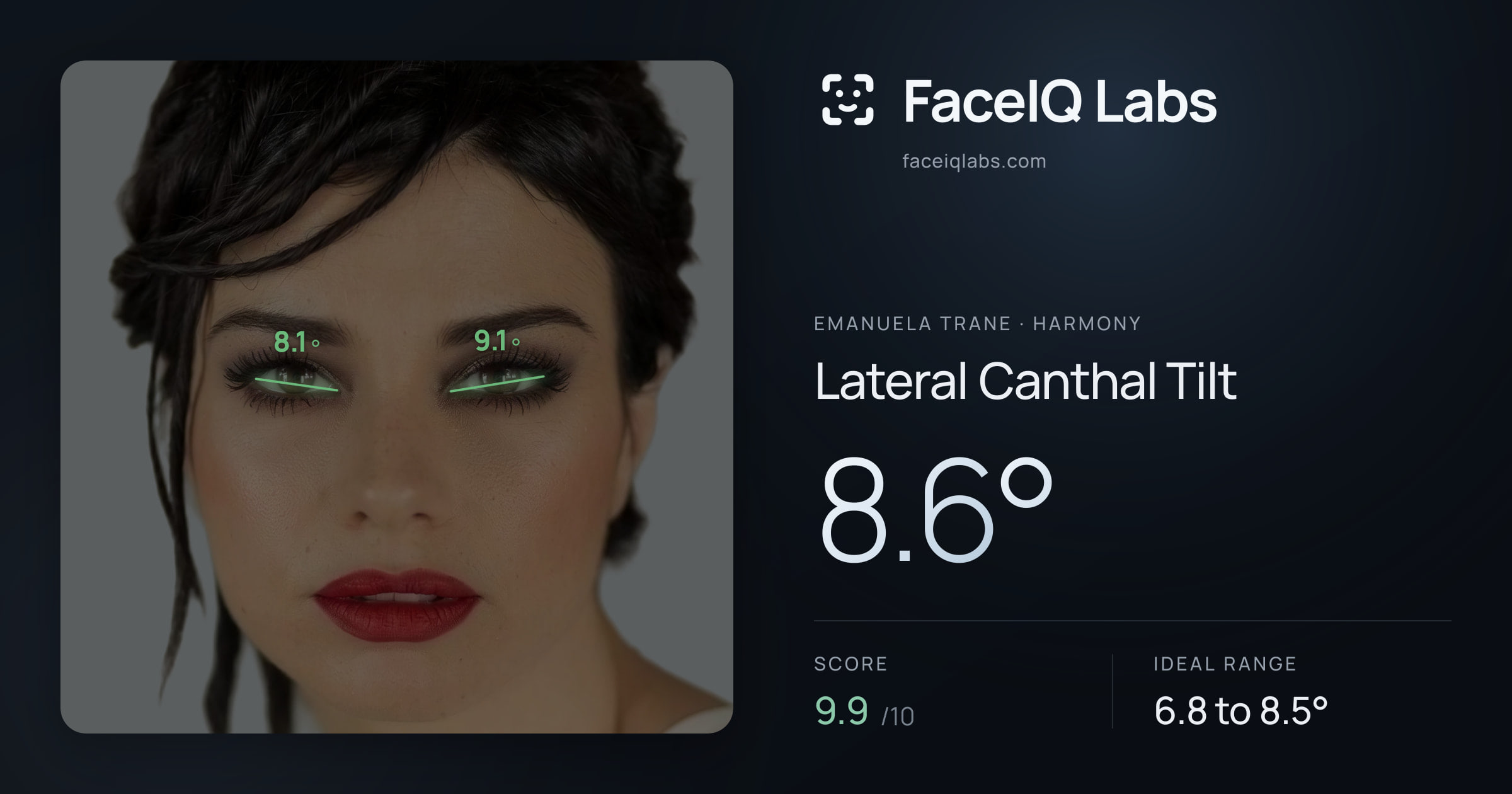 Emanuela Trane Lateral Canthal Tilt: 8.6°, drawn on the photo