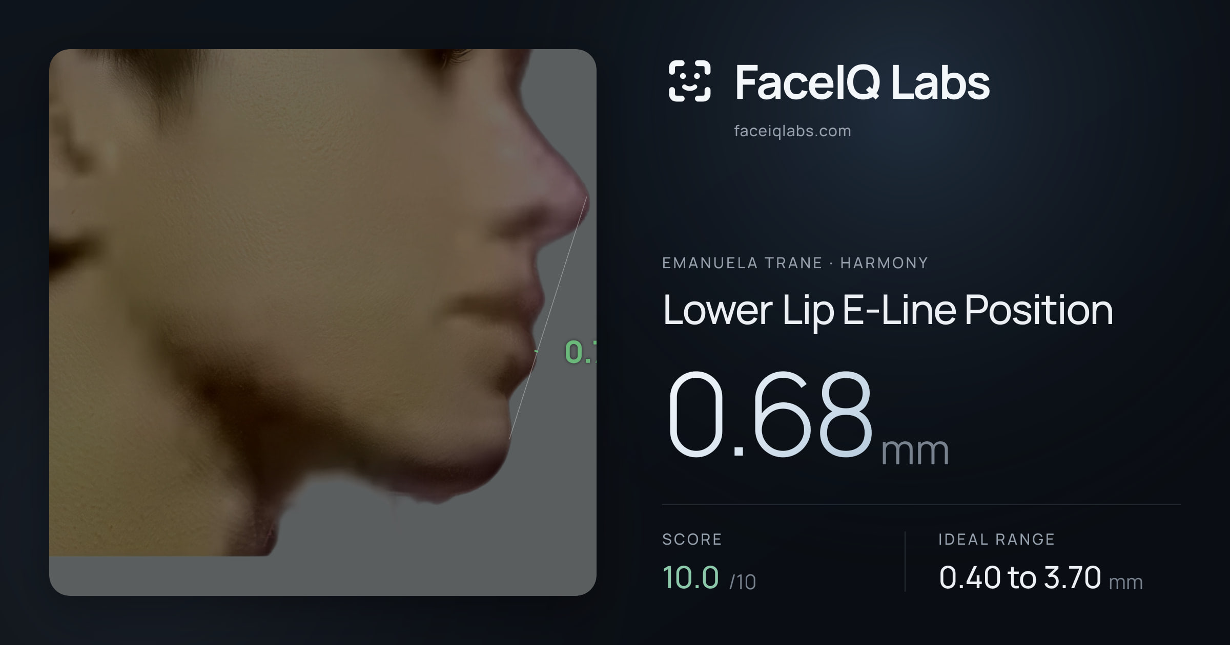 Emanuela Trane Lower Lip E-Line Position: 0.68mm, drawn on the photo
