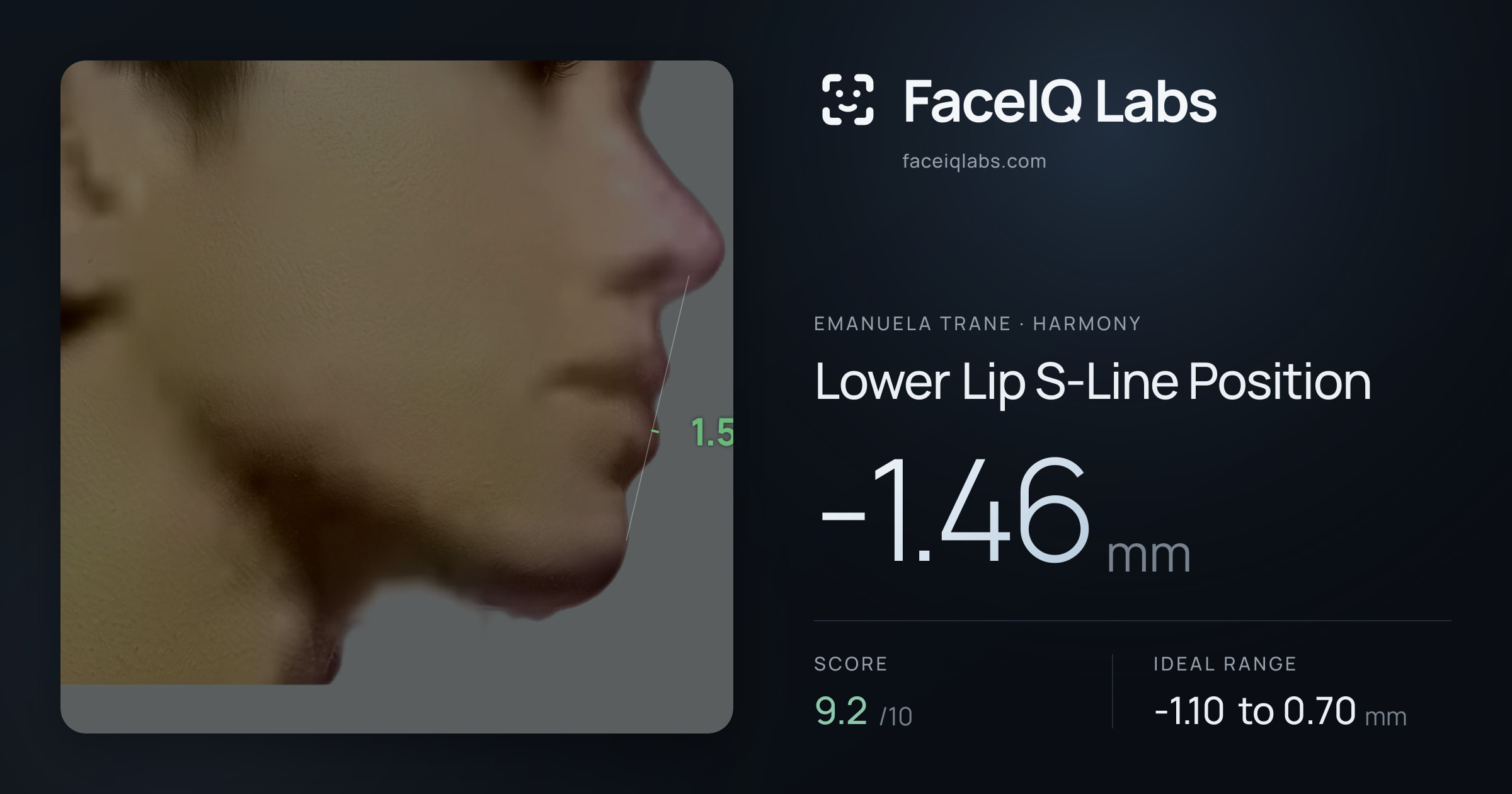 Emanuela Trane Lower Lip S-Line Position: -1.46mm, drawn on the photo