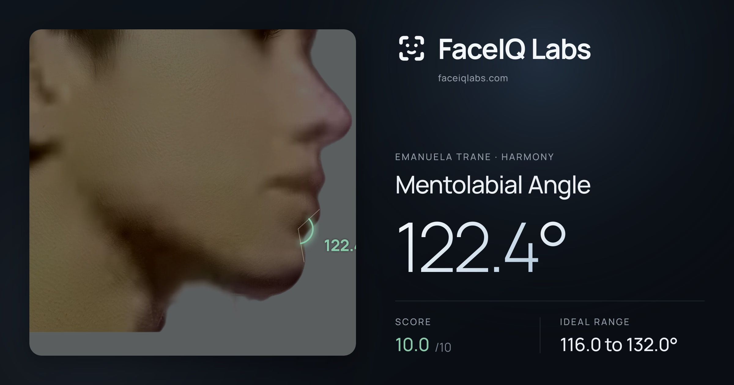Emanuela Trane Mentolabial Angle: 122.4°, drawn on the photo