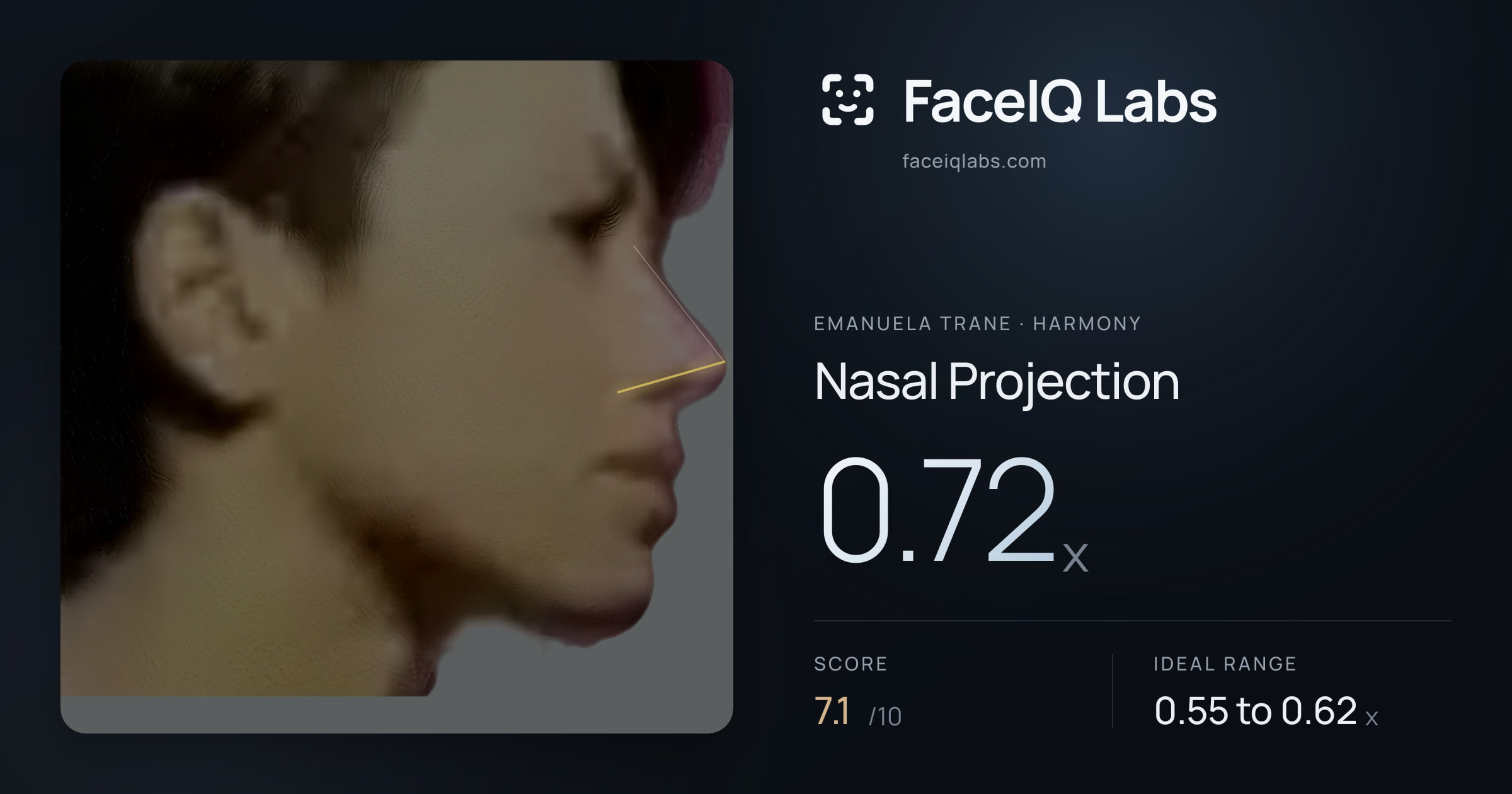 Emanuela Trane Nasal Projection: 0.72x, drawn on the photo