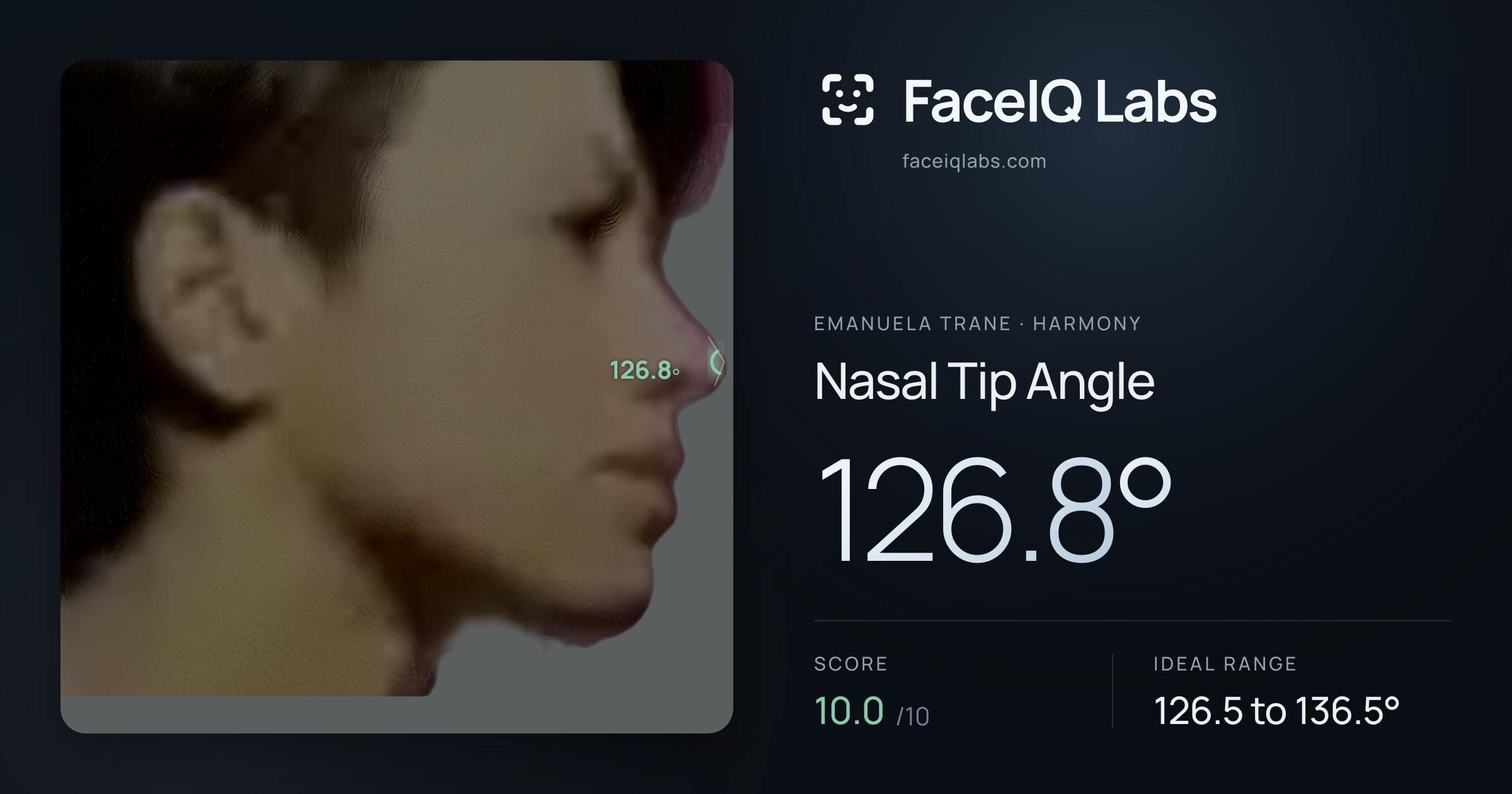 Emanuela Trane Nasal Tip Angle: 126.8°, drawn on the photo