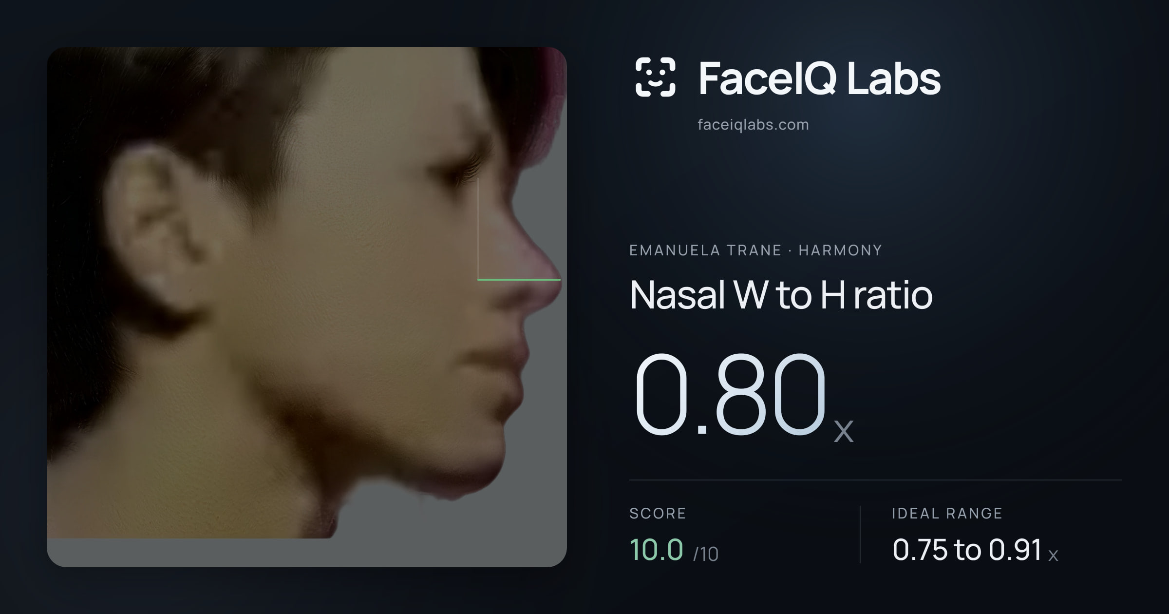 Emanuela Trane Nasal W to H ratio: 0.80x, drawn on the photo