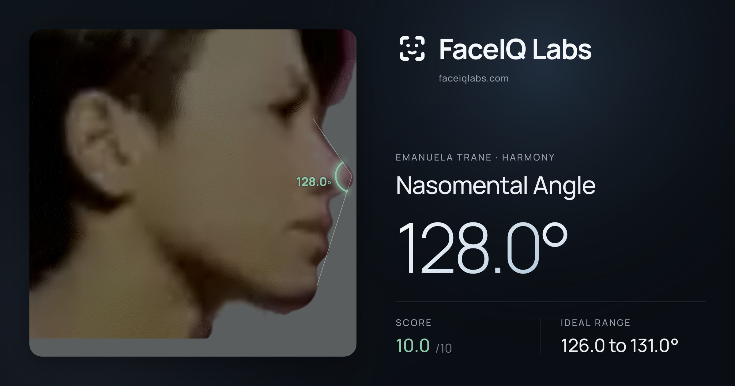 Emanuela Trane Nasomental Angle: 128.0°, drawn on the photo