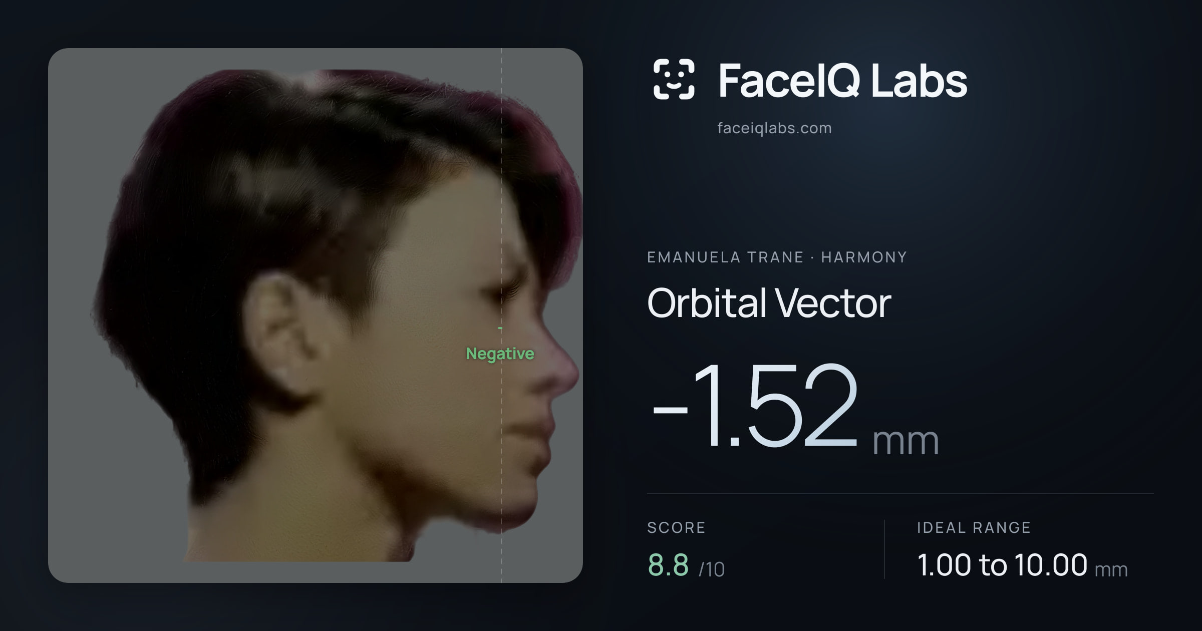 Emanuela Trane Orbital Vector: -1.52mm, drawn on the photo