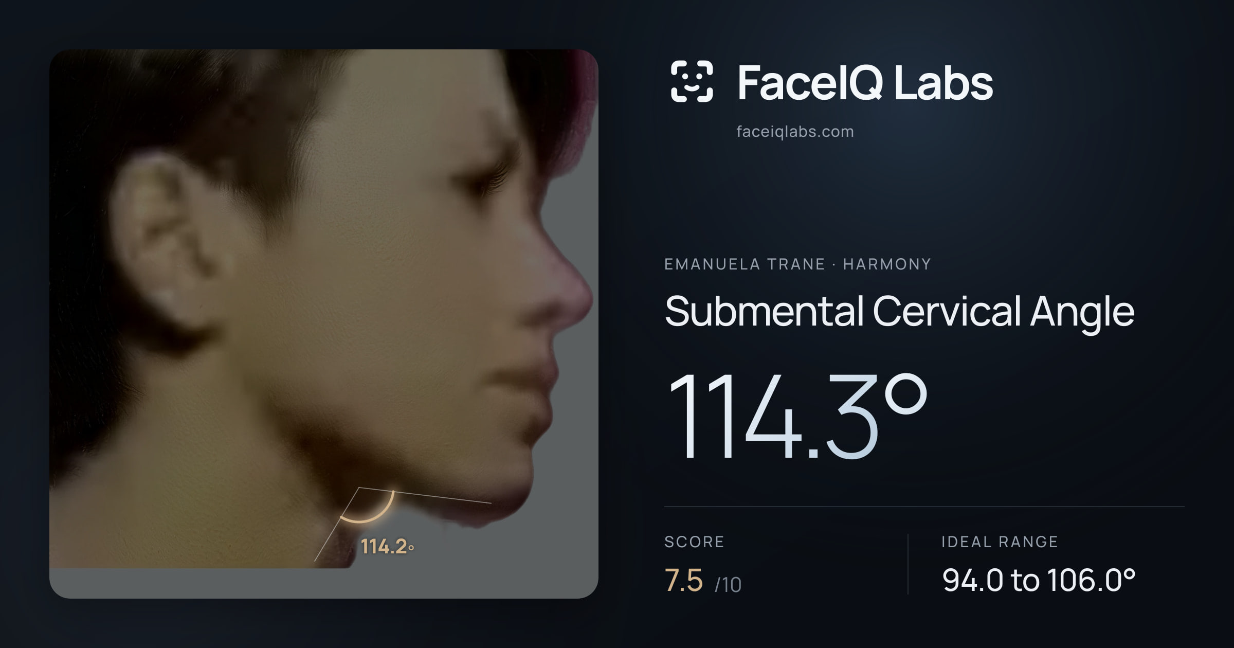 Emanuela Trane Submental Cervical Angle: 114.3°, drawn on the photo