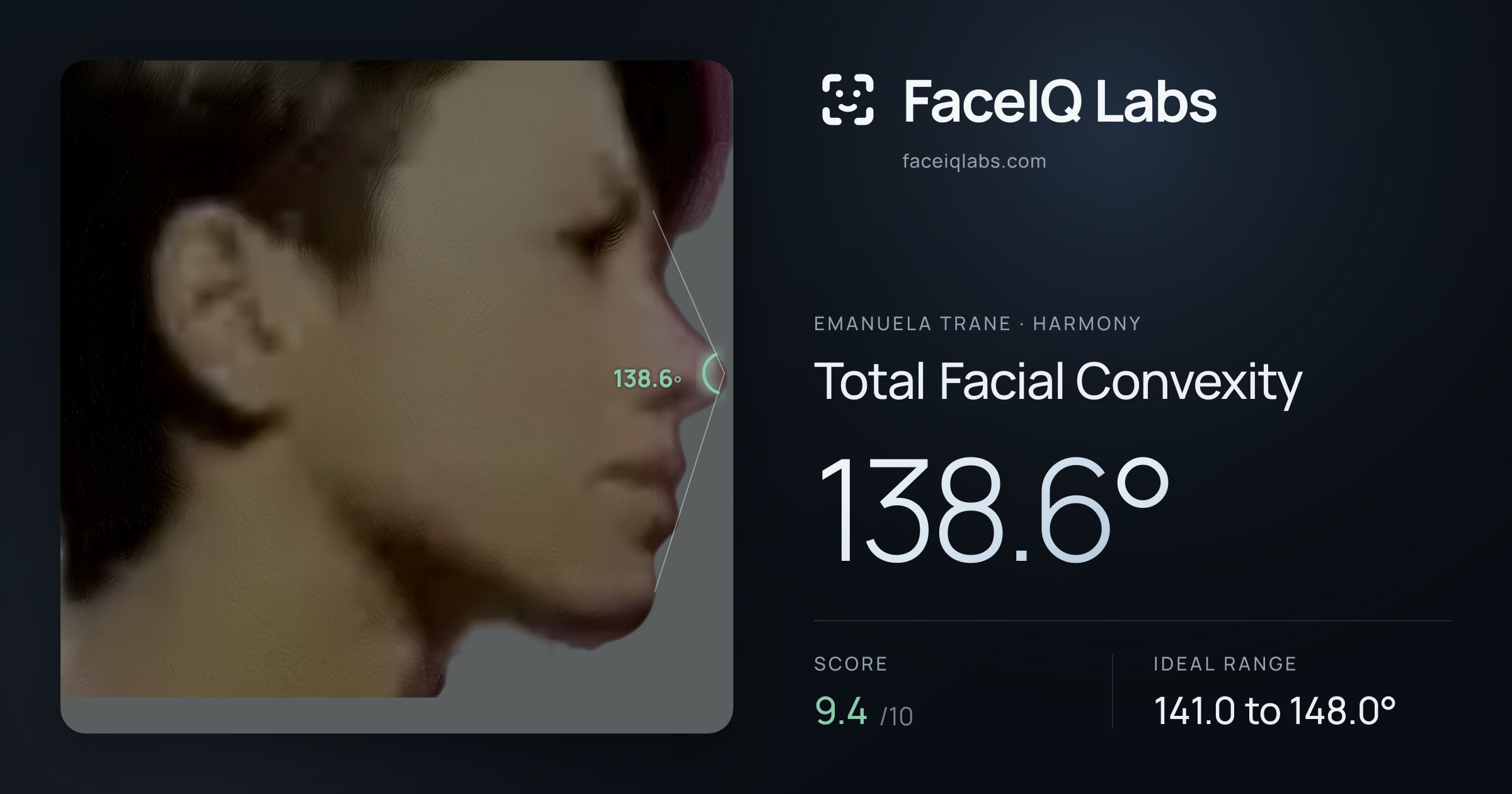 Emanuela Trane Total Facial Convexity: 138.6°, drawn on the photo