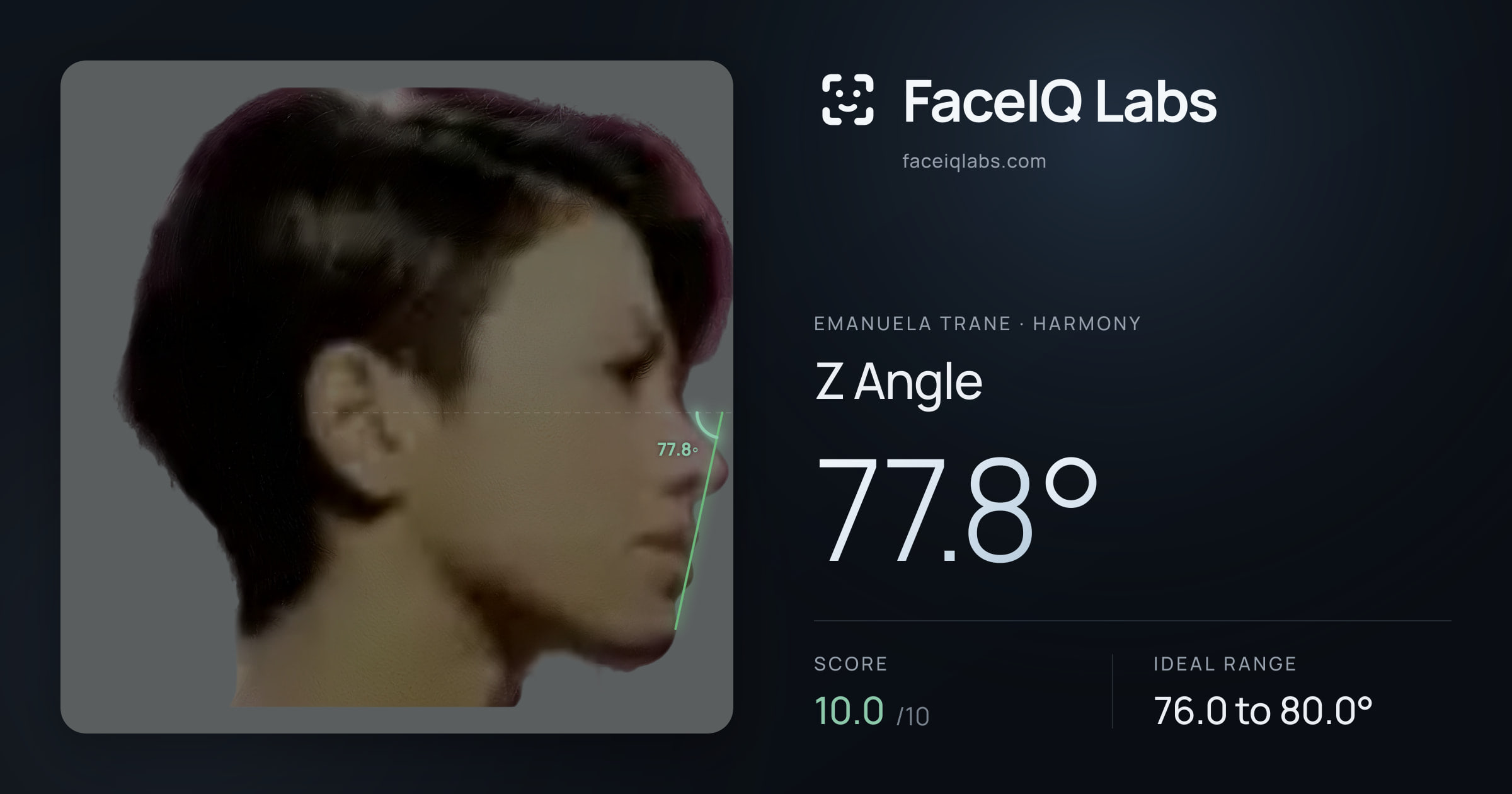Emanuela Trane Z Angle: 77.8°, drawn on the photo