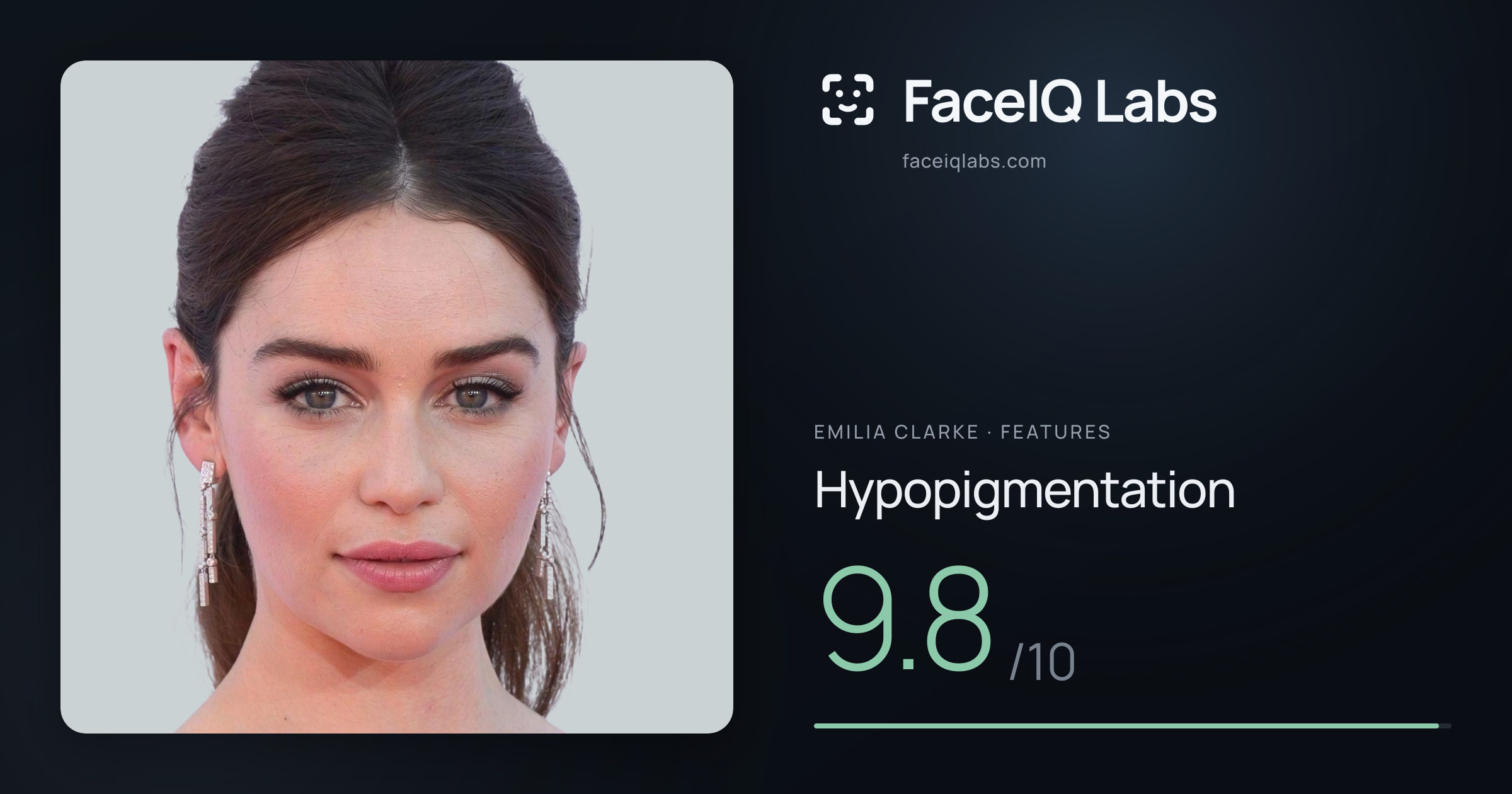 Emilia Clarke Hypopigmentation: 9.8/10, drawn on the photo