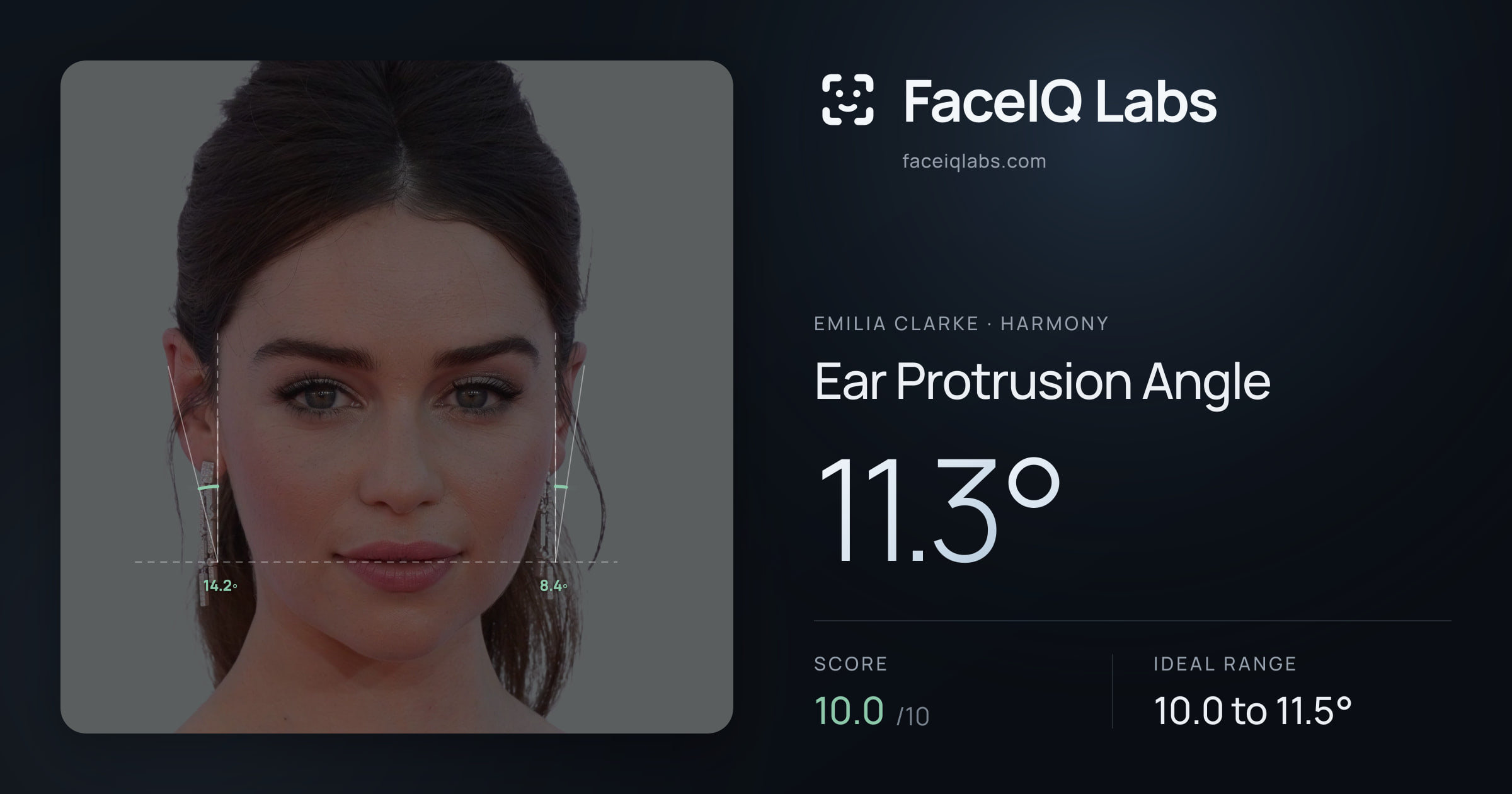 Emilia Clarke Ear Protrusion Angle: 11.3°, drawn on the photo
