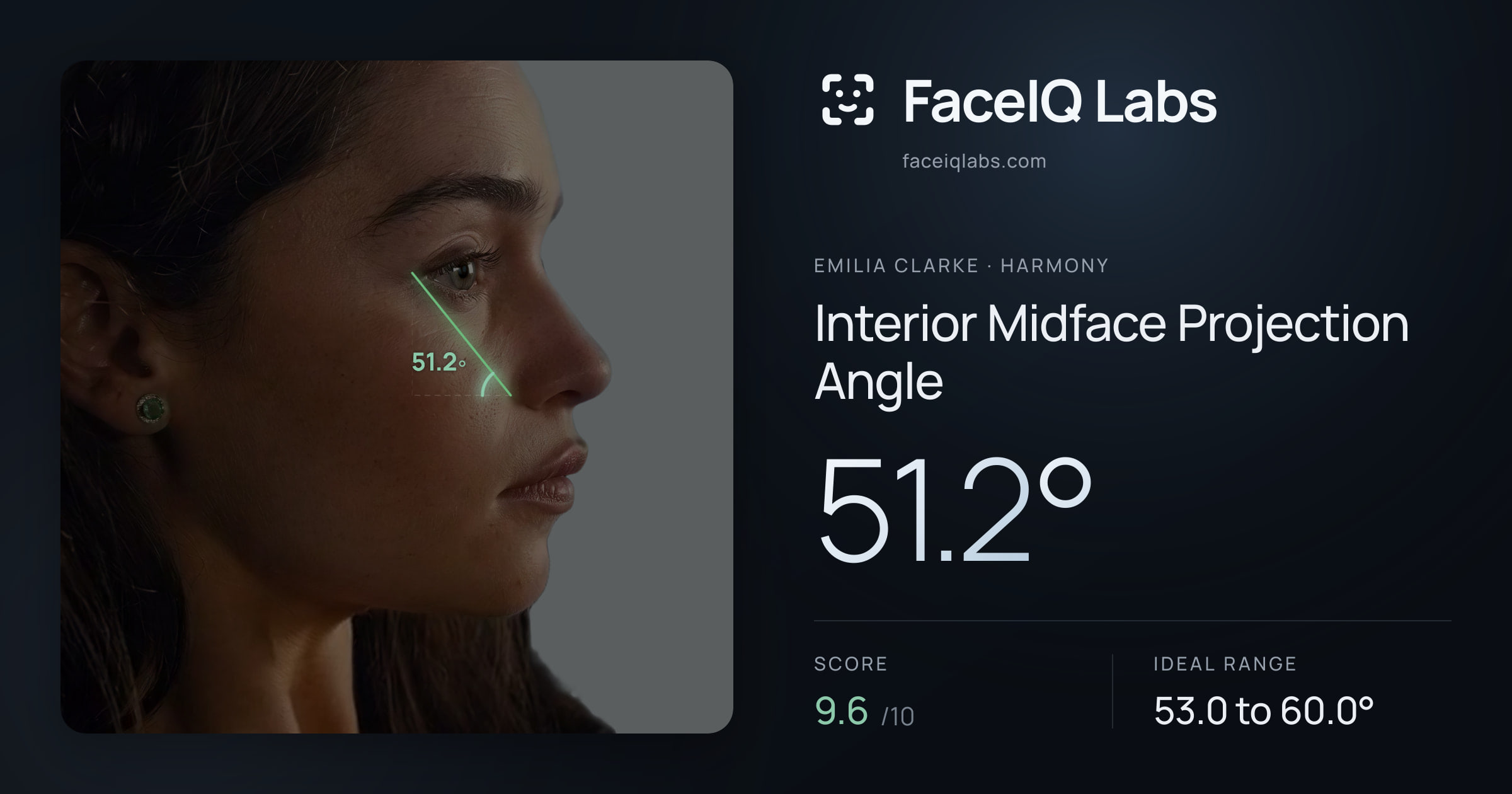 Emilia Clarke Interior Midface Projection Angle: 51.2°, drawn on the photo