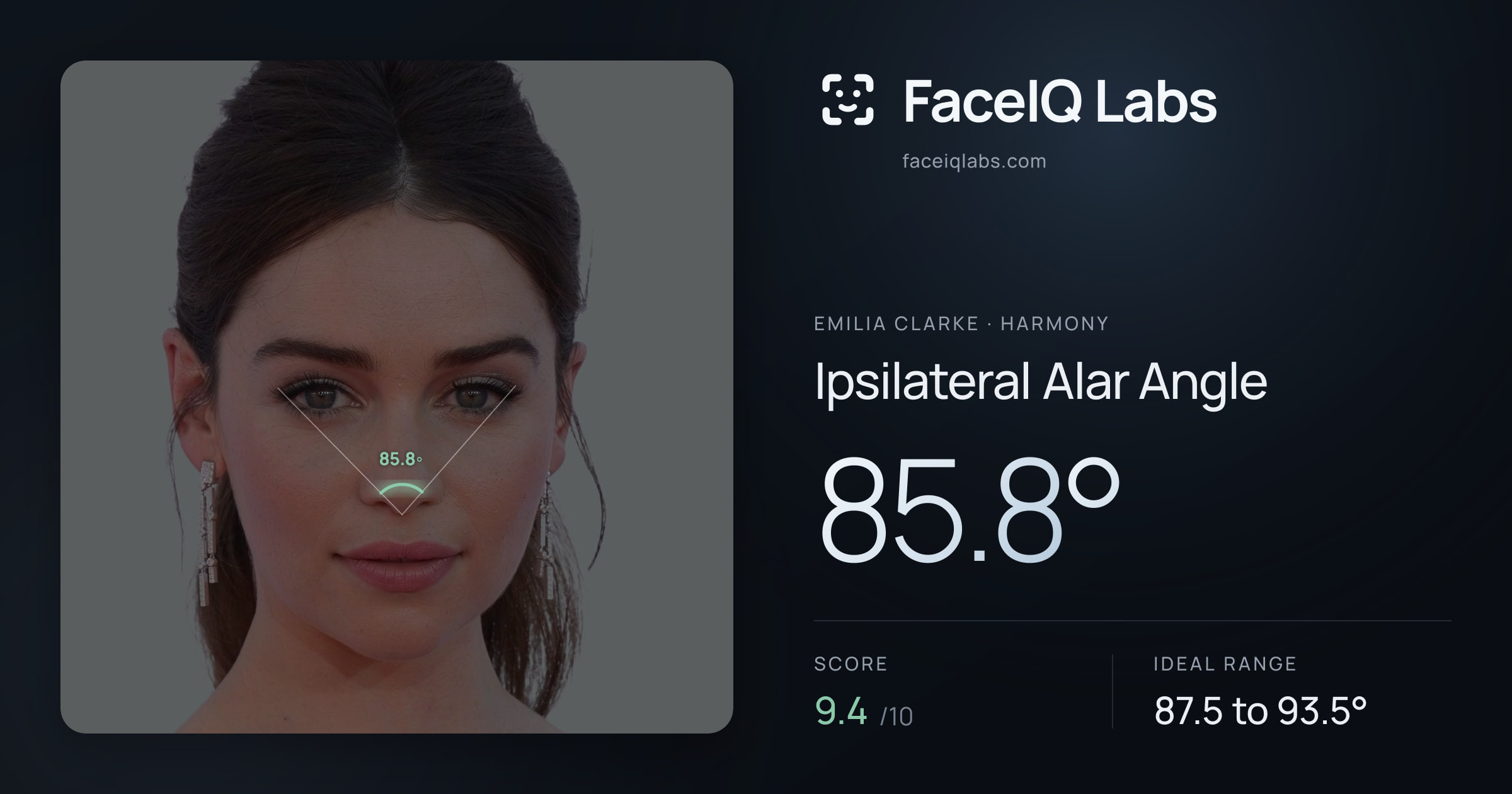 Emilia Clarke Ipsilateral Alar Angle: 85.8°, drawn on the photo