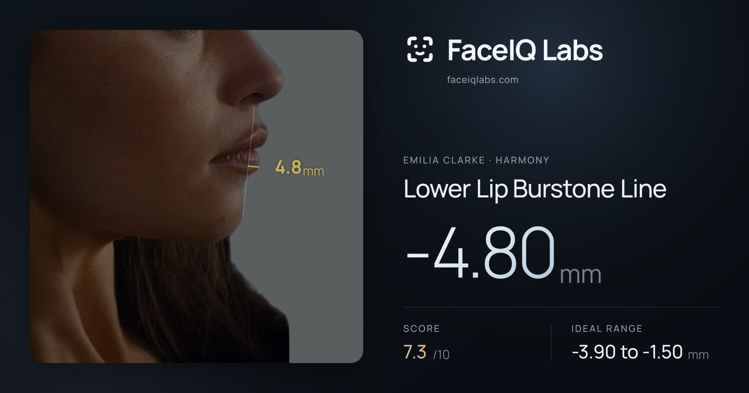 Emilia Clarke Lower Lip Burstone Line: -4.80mm, drawn on the photo