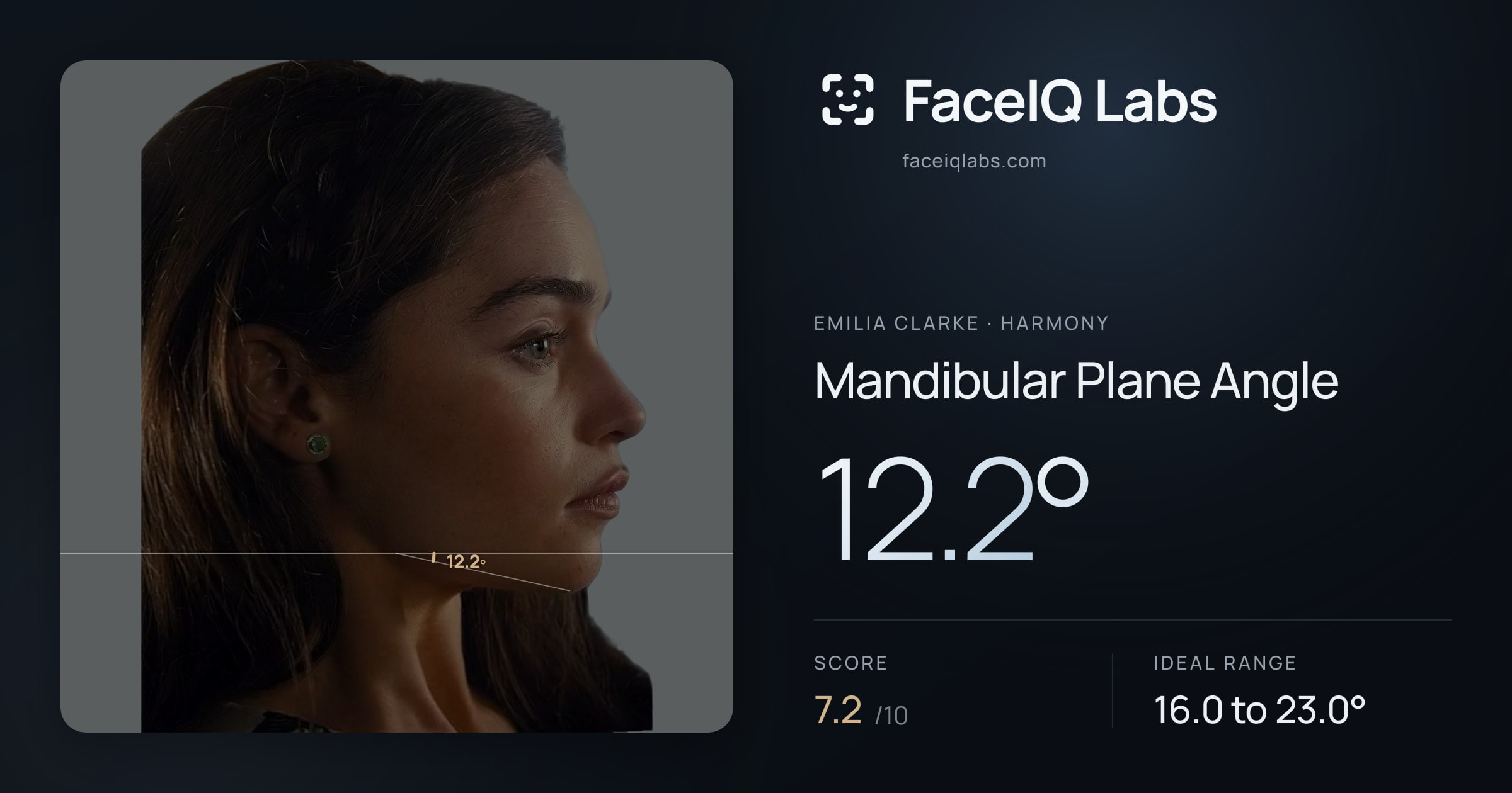 Emilia Clarke Mandibular Plane Angle: 12.2°, drawn on the photo
