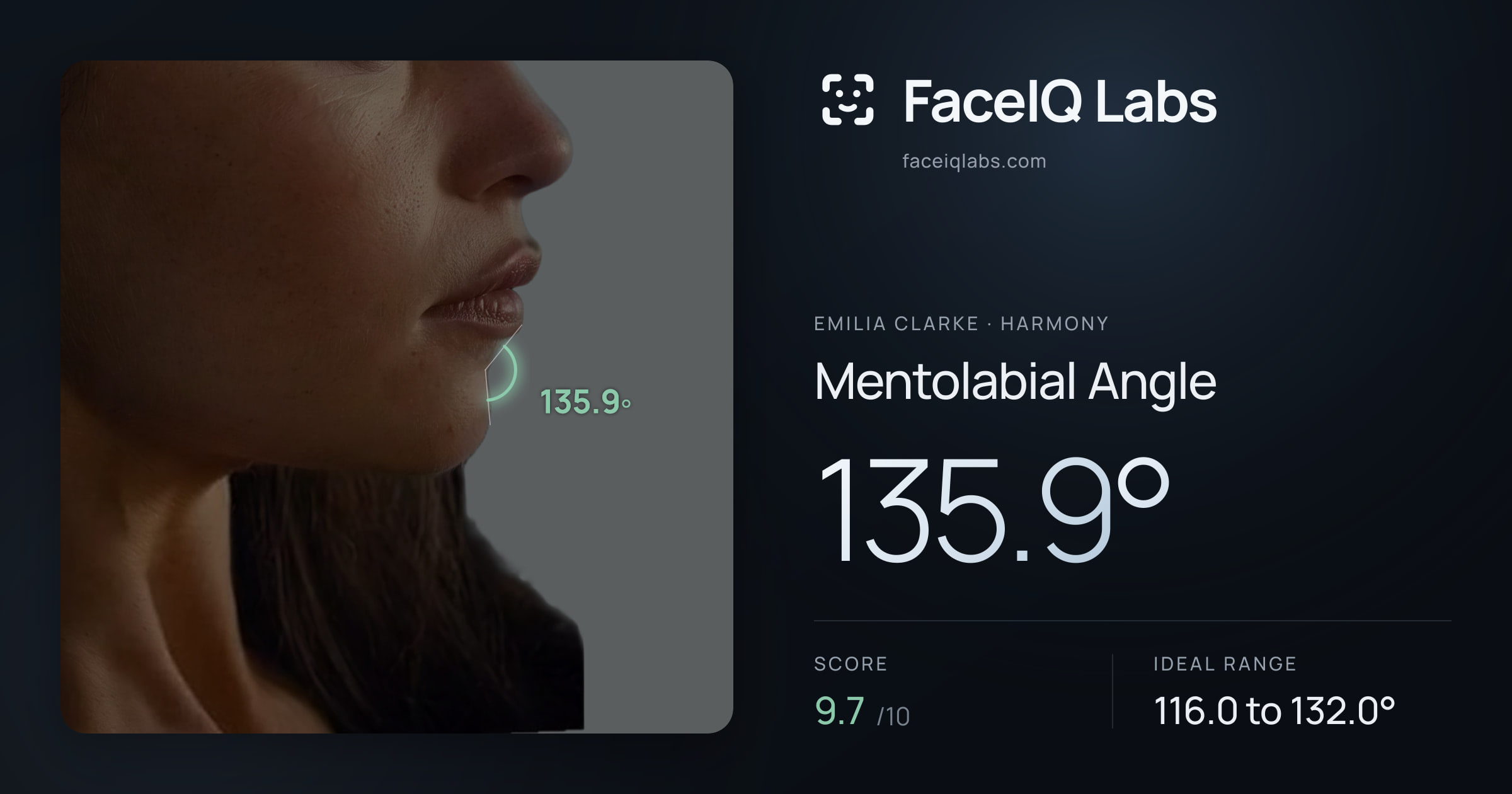 Emilia Clarke Mentolabial Angle: 135.9°, drawn on the photo