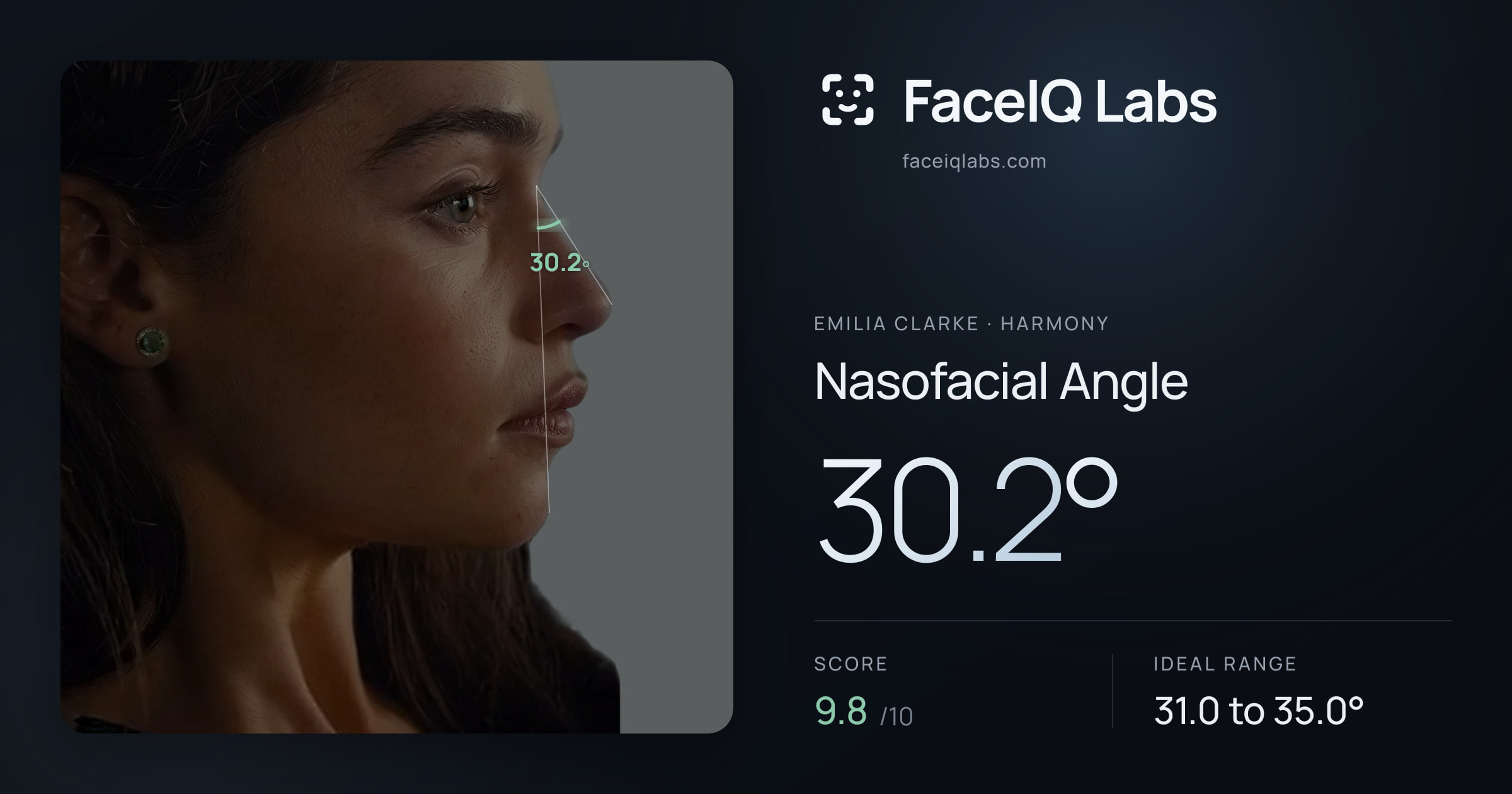 Emilia Clarke Nasofacial Angle: 30.2°, drawn on the photo