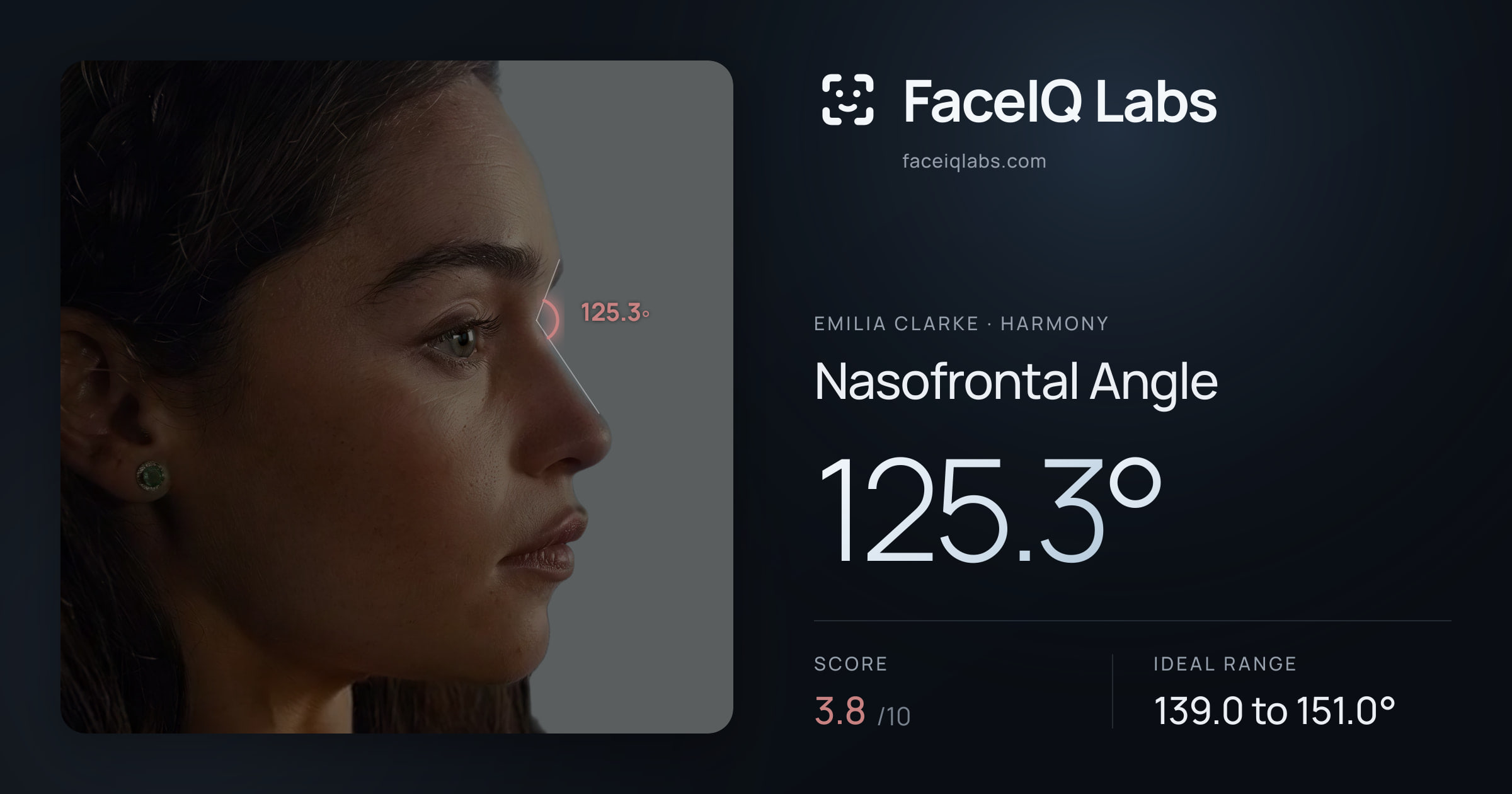 Emilia Clarke Nasofrontal Angle: 125.3°, drawn on the photo