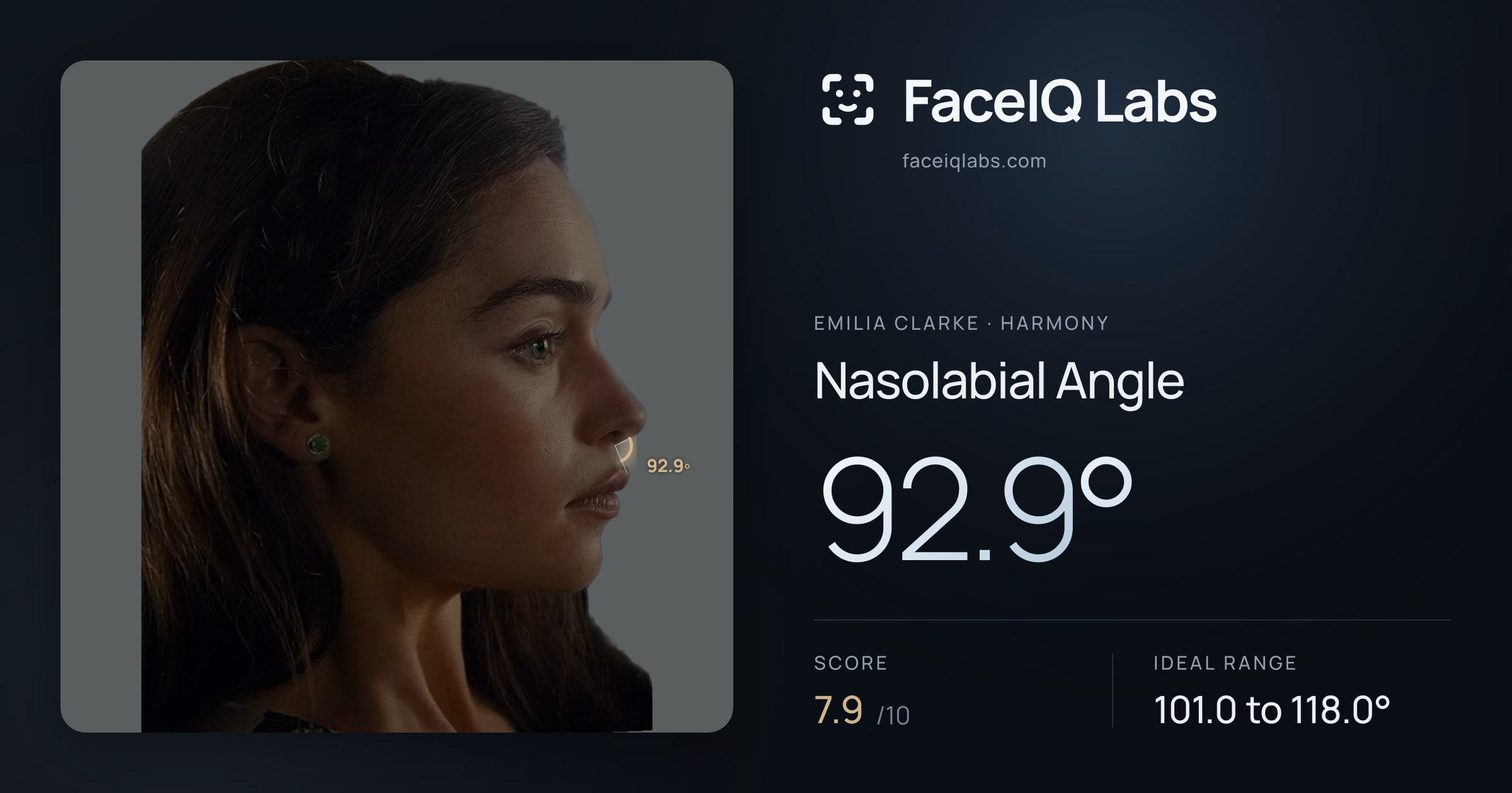 Emilia Clarke Nasolabial Angle: 92.9°, drawn on the photo