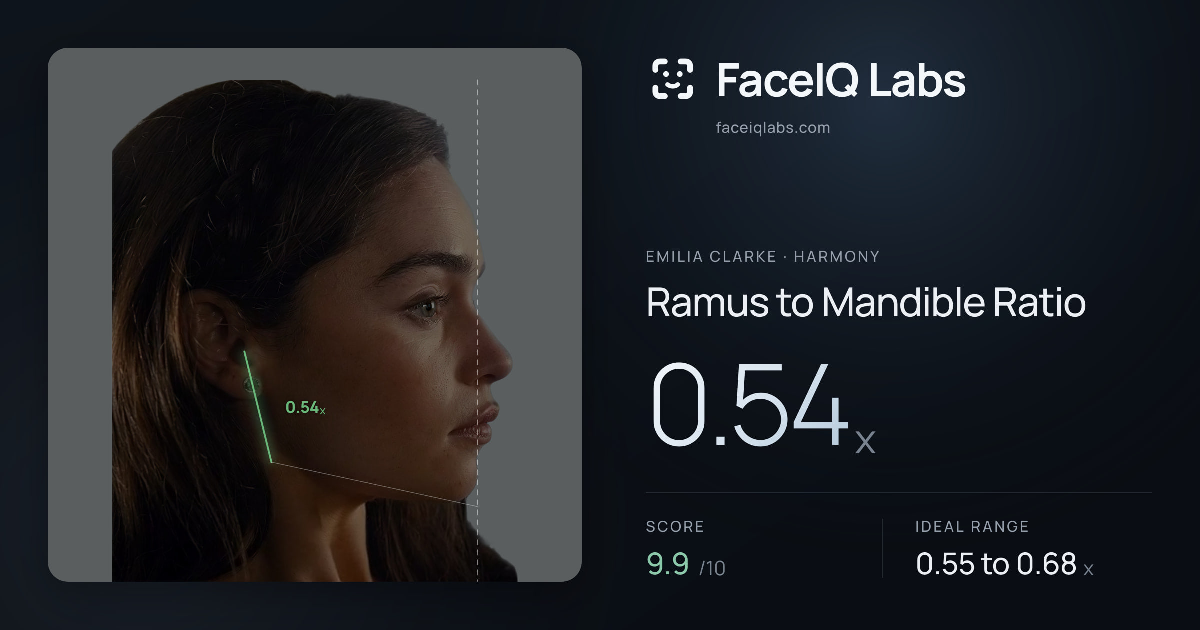 Emilia Clarke Ramus to Mandible Ratio: 0.54x, drawn on the photo
