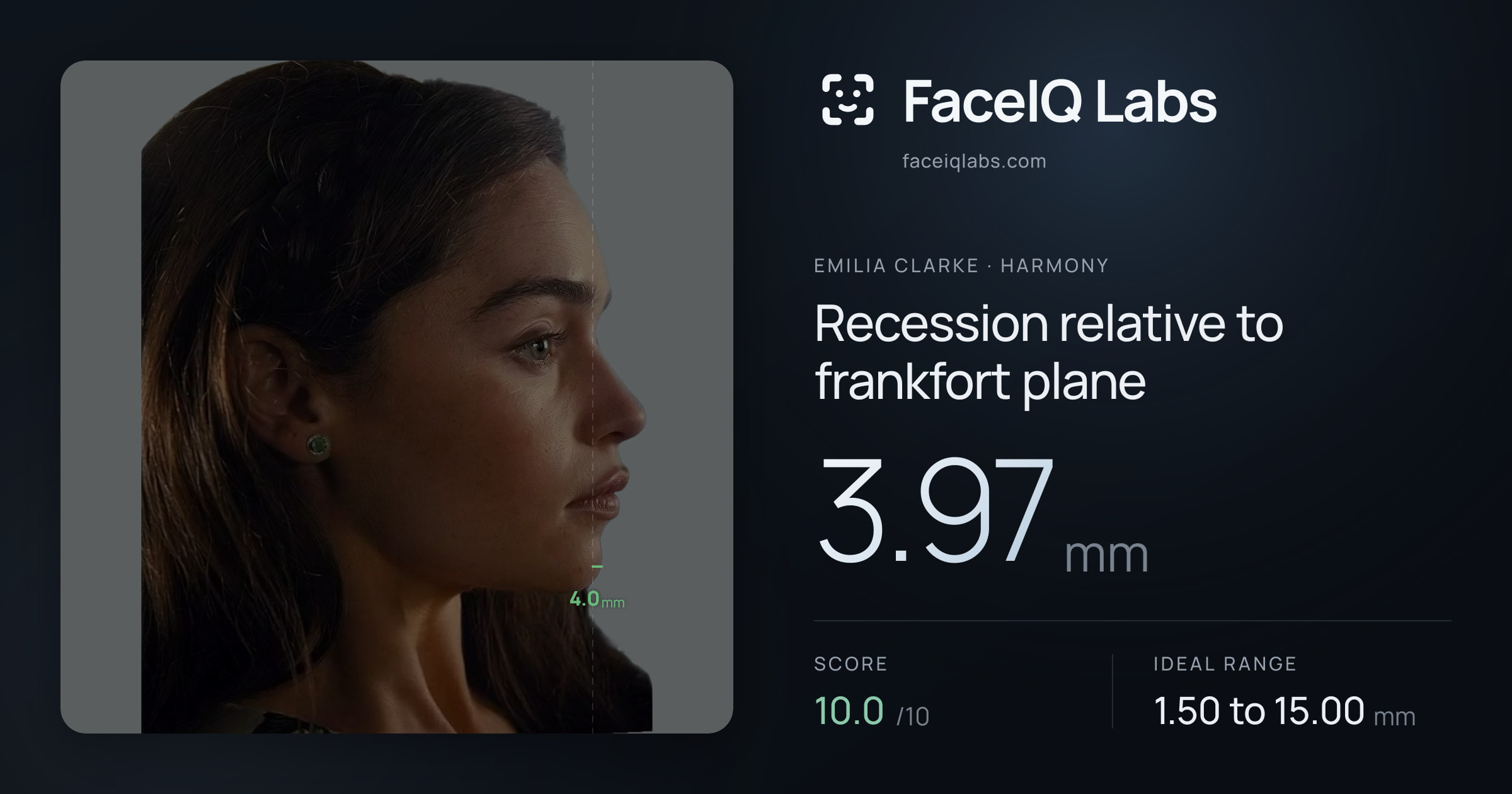 Emilia Clarke Recession relative to frankfort plane: 3.97mm, drawn on the photo