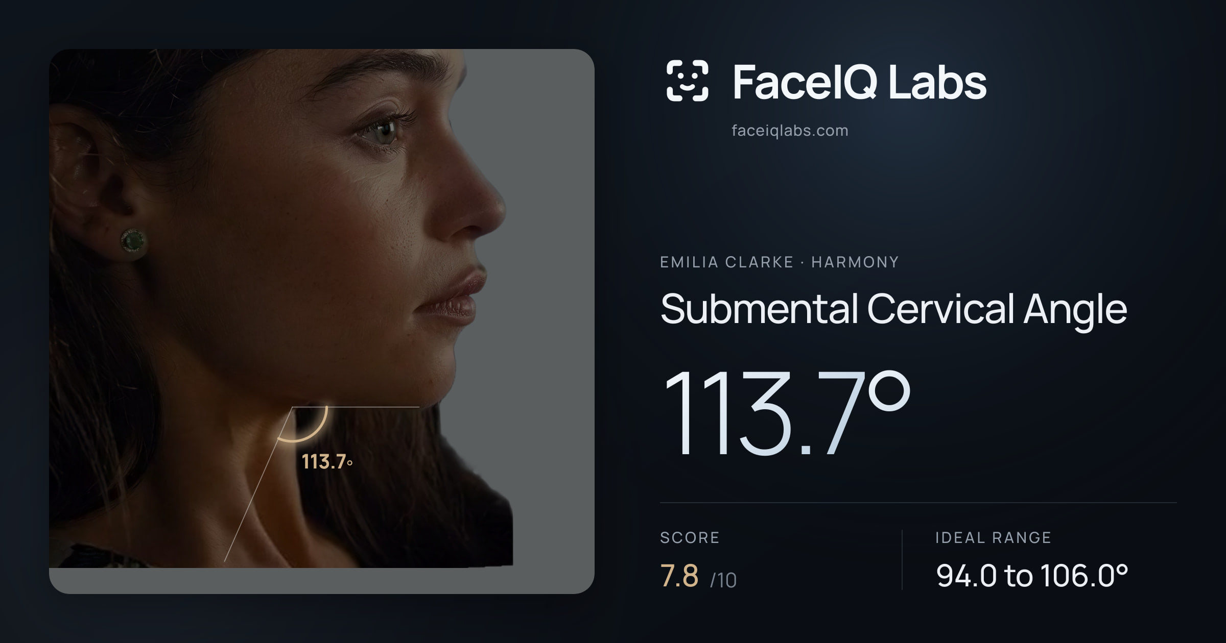 Emilia Clarke Submental Cervical Angle: 113.7°, drawn on the photo