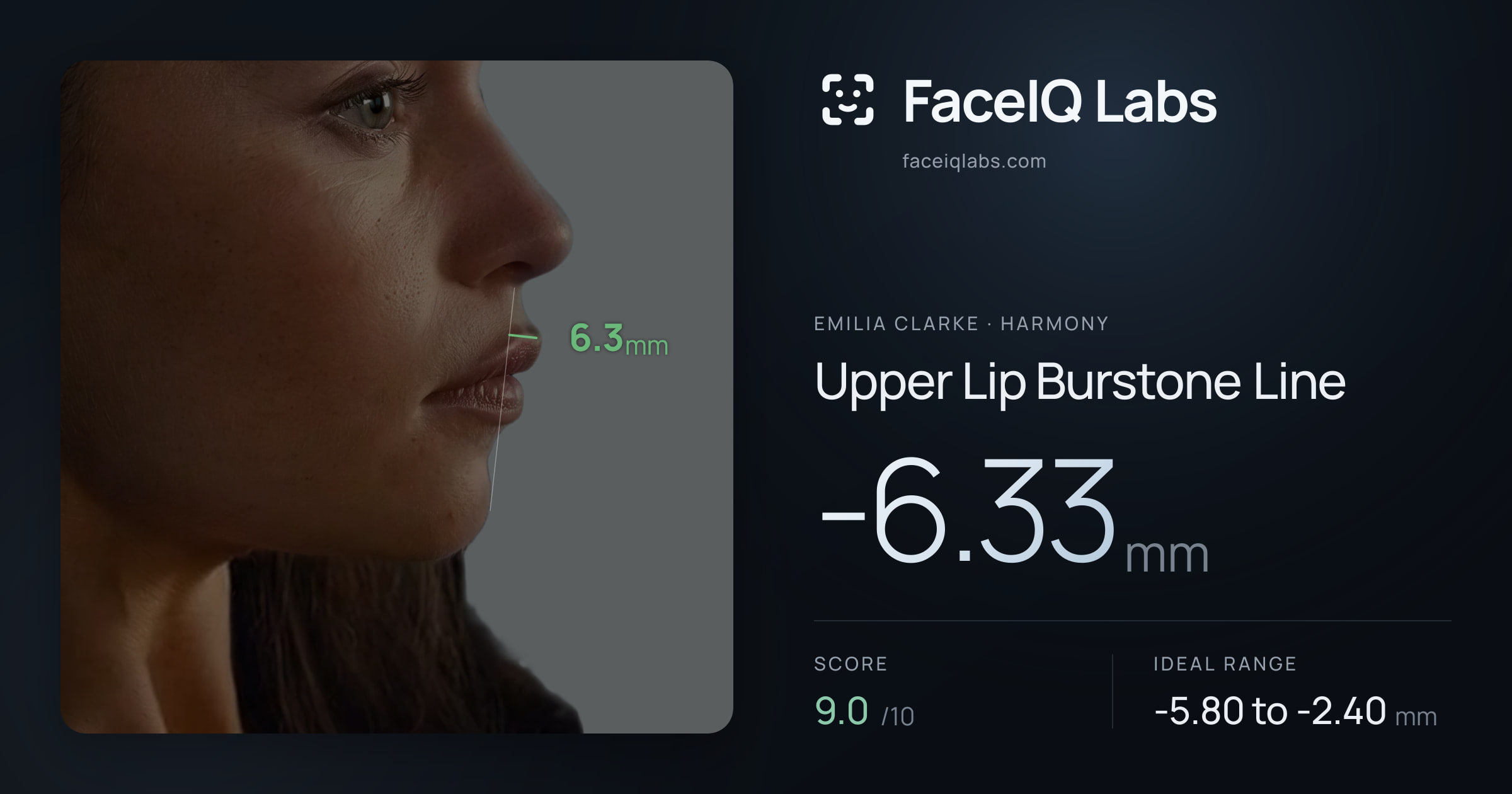 Emilia Clarke Upper Lip Burstone Line: -6.33mm, drawn on the photo