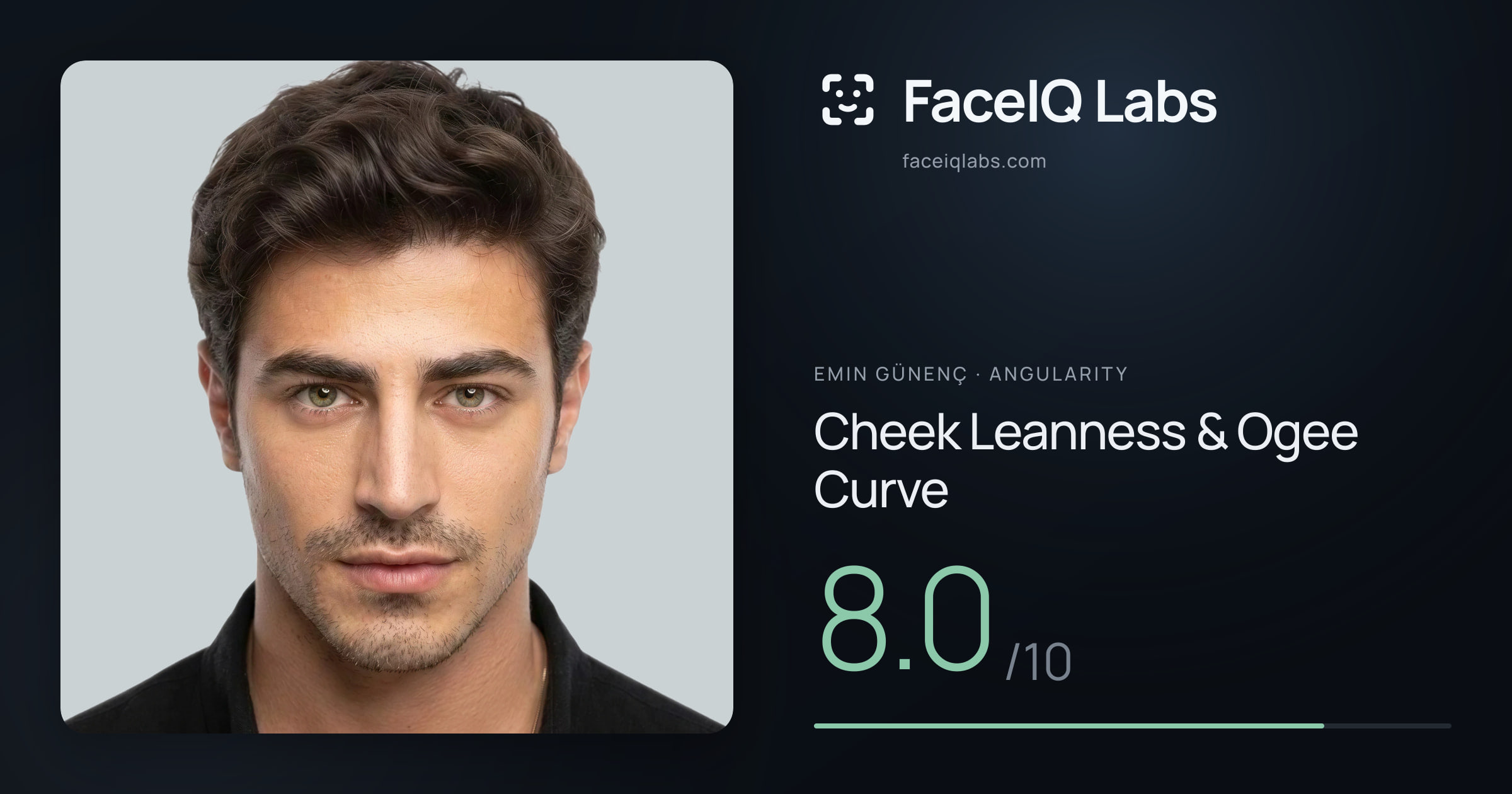 Emin Günenç Cheek Leanness & Ogee Curve: 8.0/10, drawn on the photo