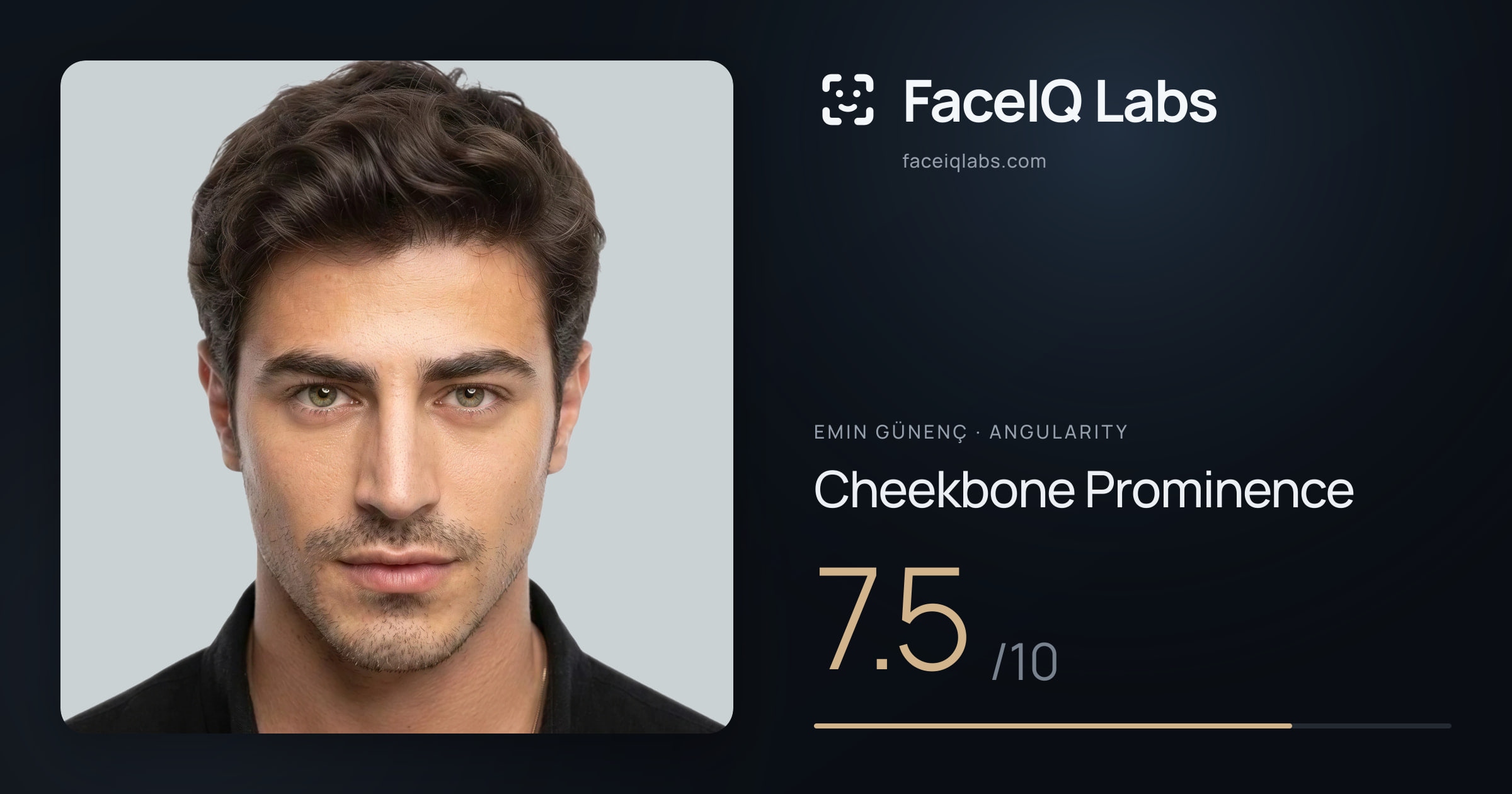 Emin Günenç Cheekbone Prominence: 7.5/10, drawn on the photo