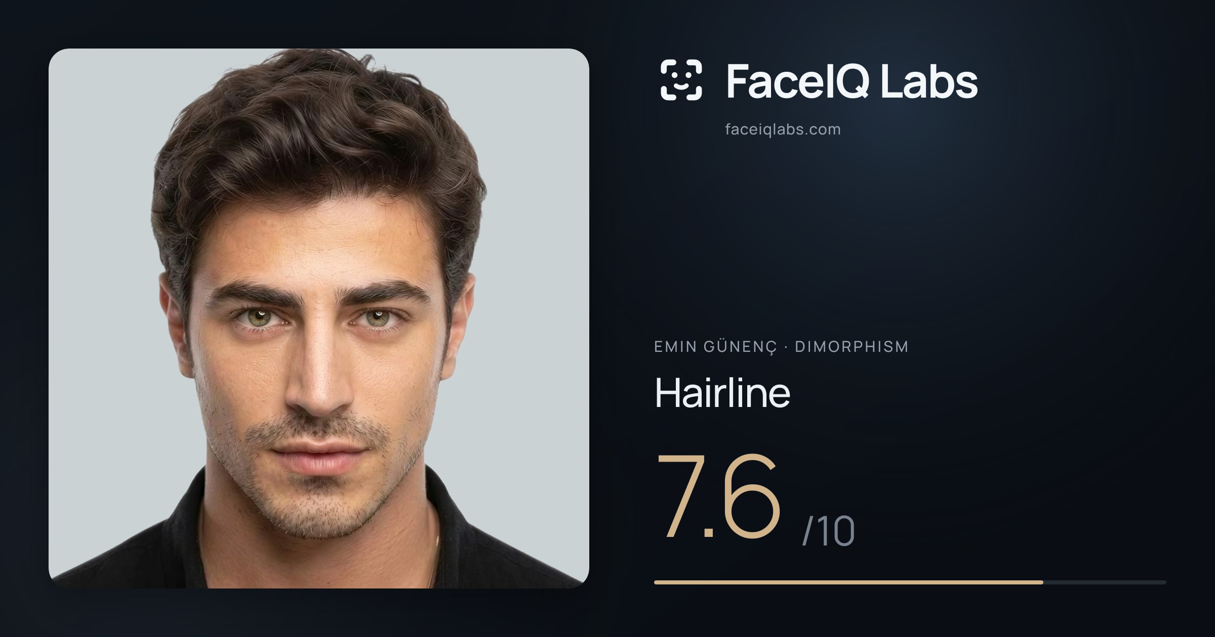 Emin Günenç Hairline: 7.6/10, drawn on the photo