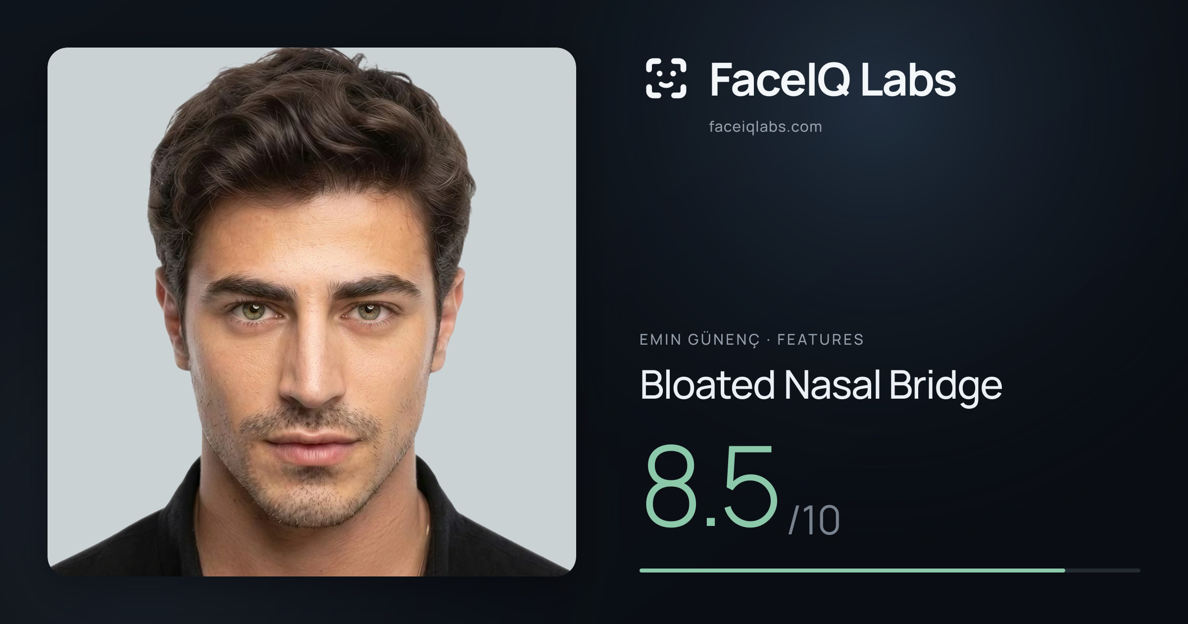 Emin Günenç Bloated Nasal Bridge: 8.5/10, drawn on the photo
