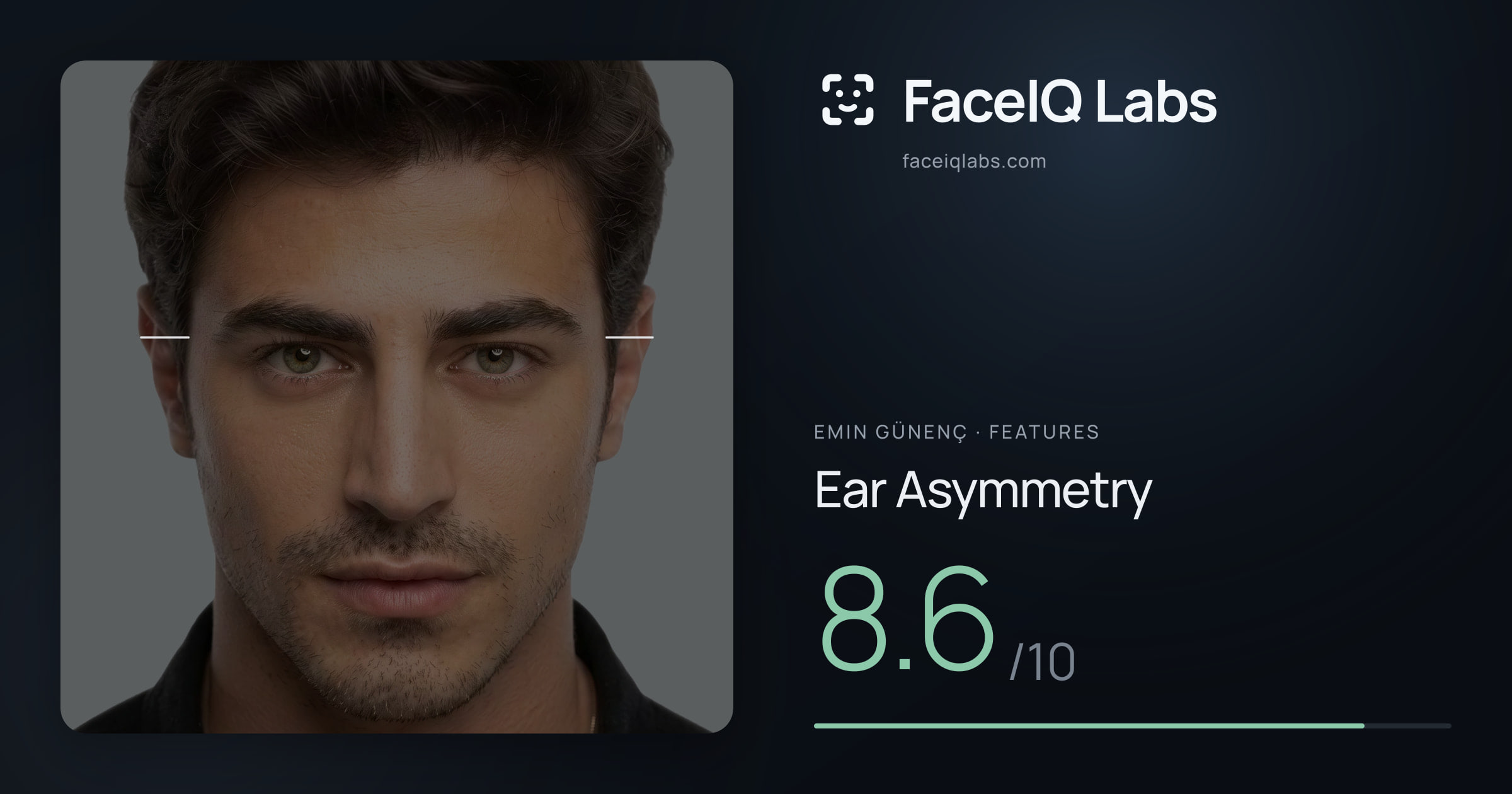 Emin Günenç Ear Asymmetry: 8.6/10, drawn on the photo