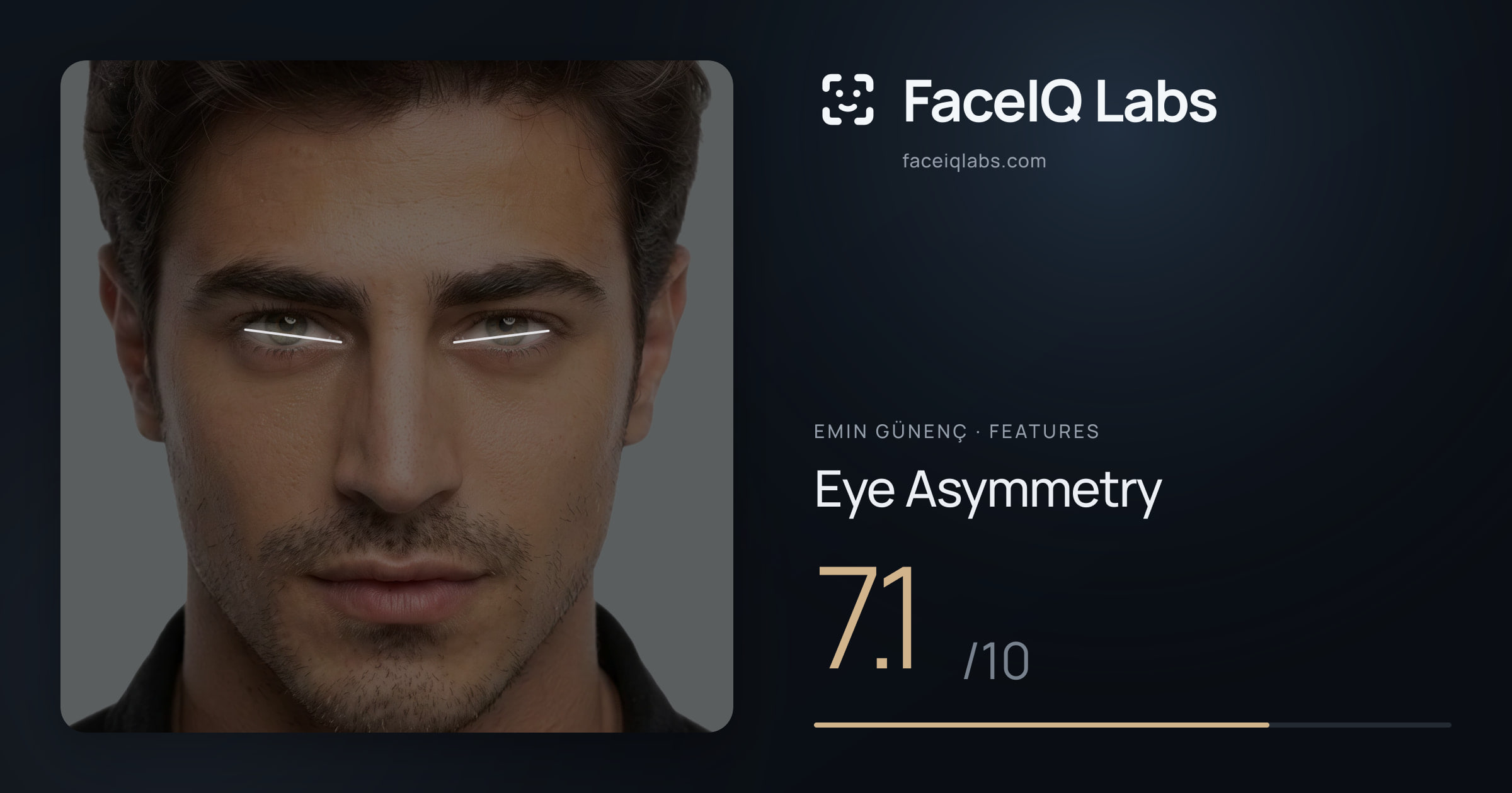 Emin Günenç Eye Asymmetry: 7.1/10, drawn on the photo