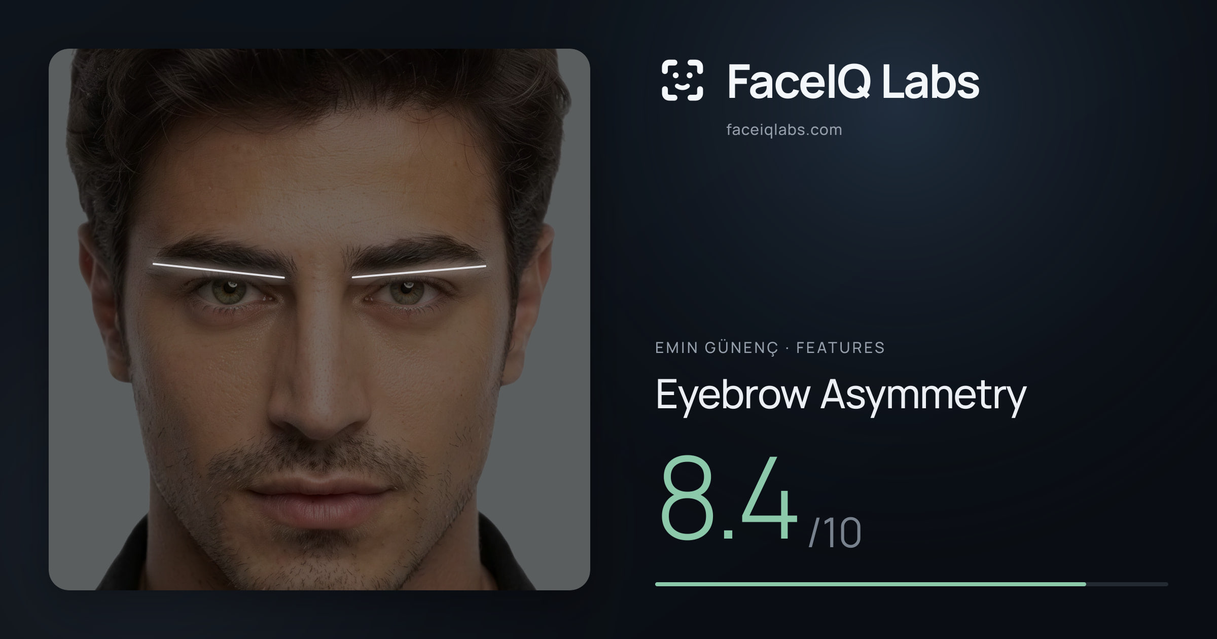 Emin Günenç Eyebrow Asymmetry: 8.4/10, drawn on the photo