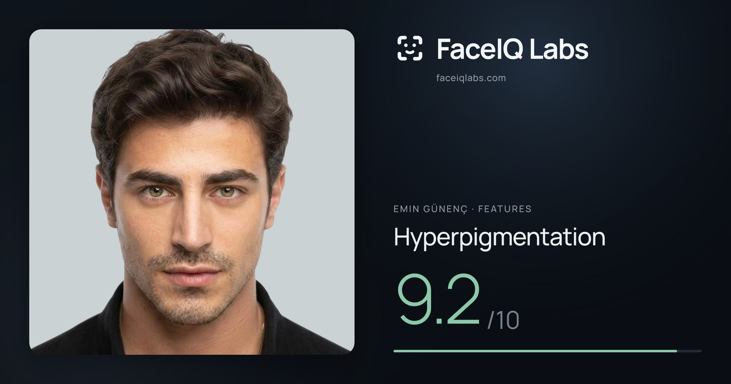 Emin Günenç Hyperpigmentation: 9.2/10, drawn on the photo