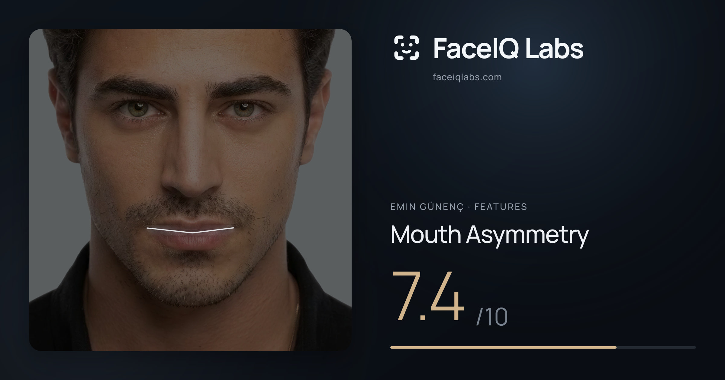 Emin Günenç Mouth Asymmetry: 7.4/10, drawn on the photo