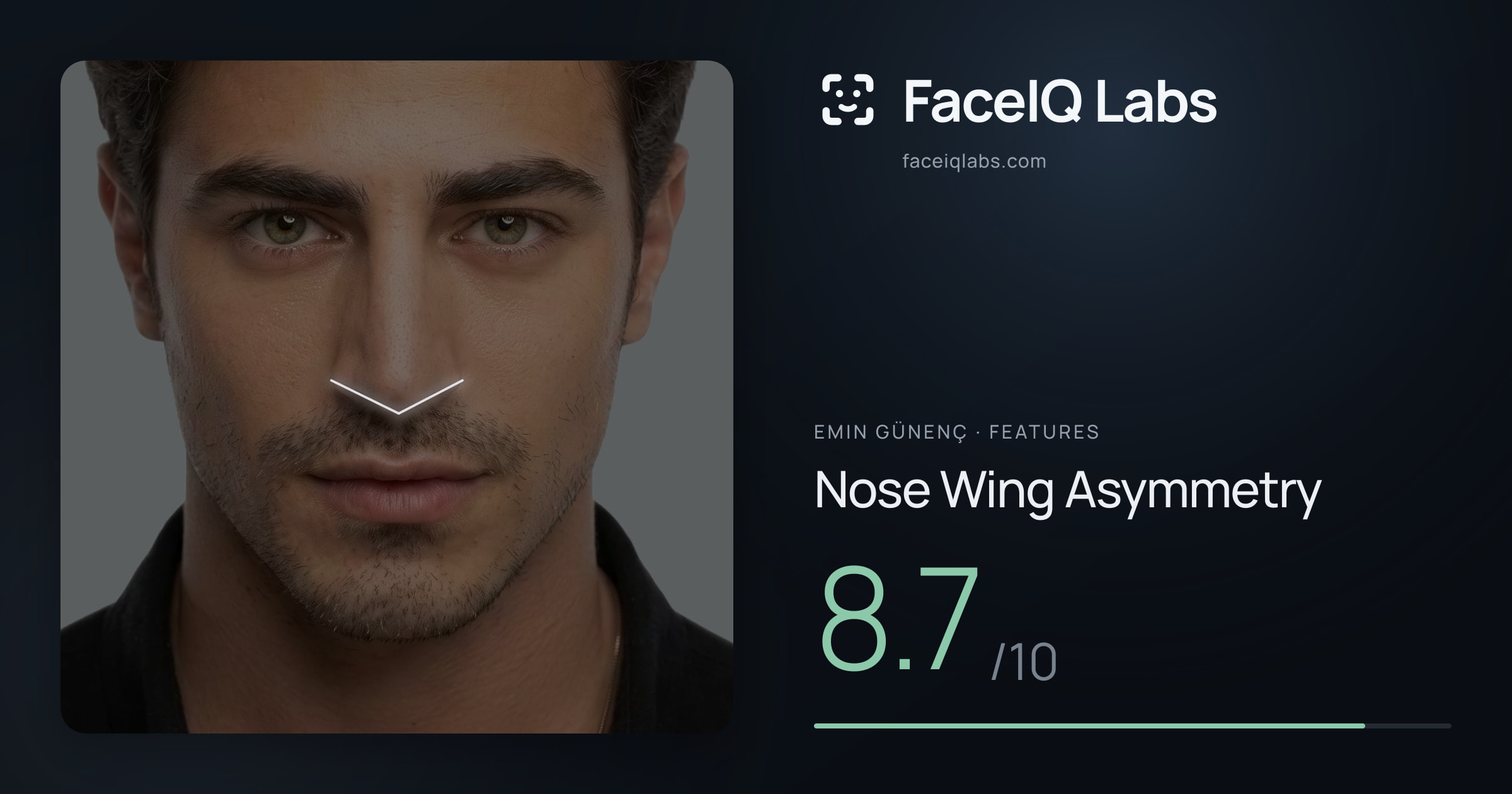 Emin Günenç Nose Wing Asymmetry: 8.7/10, drawn on the photo