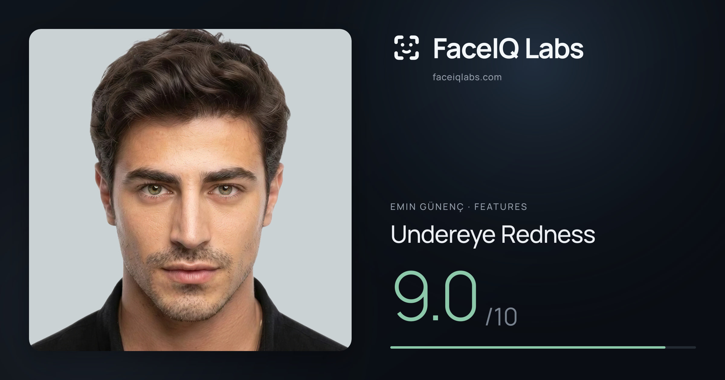 Emin Günenç Undereye Redness: 9.0/10, drawn on the photo
