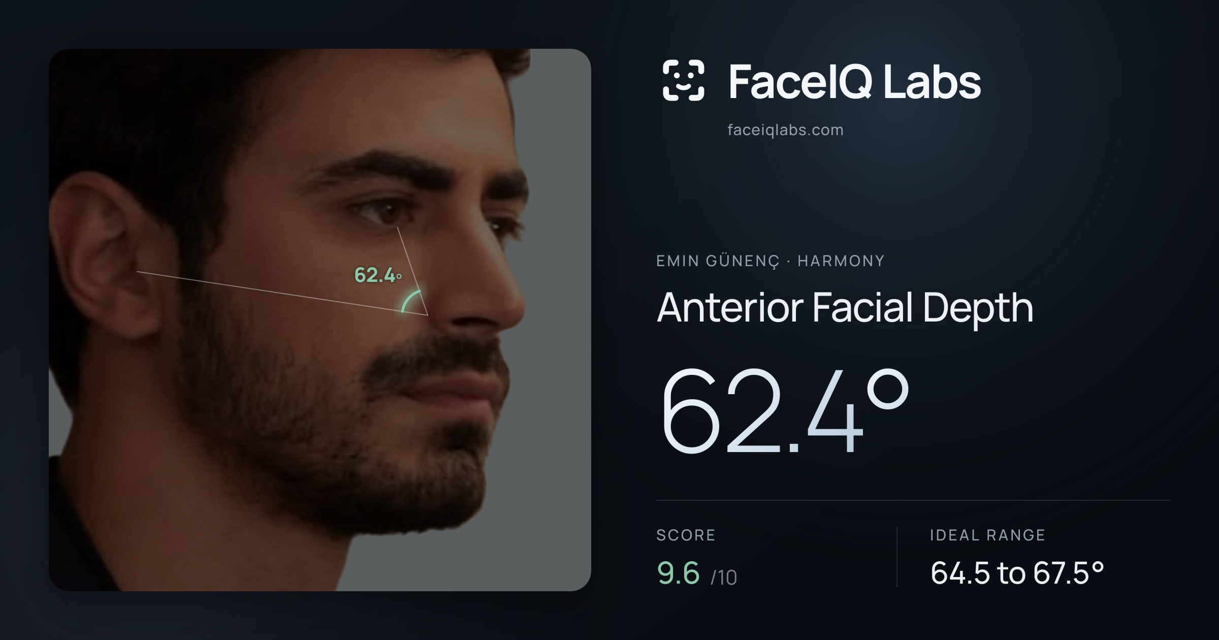 Emin Günenç Anterior Facial Depth: 62.4°, drawn on the photo