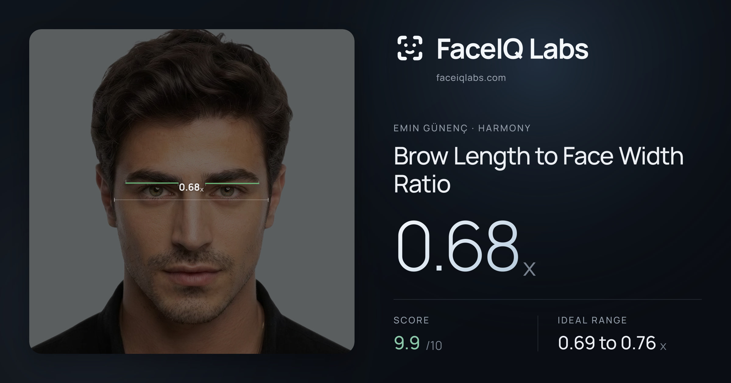 Emin Günenç Brow Length to Face Width Ratio: 0.68x, drawn on the photo