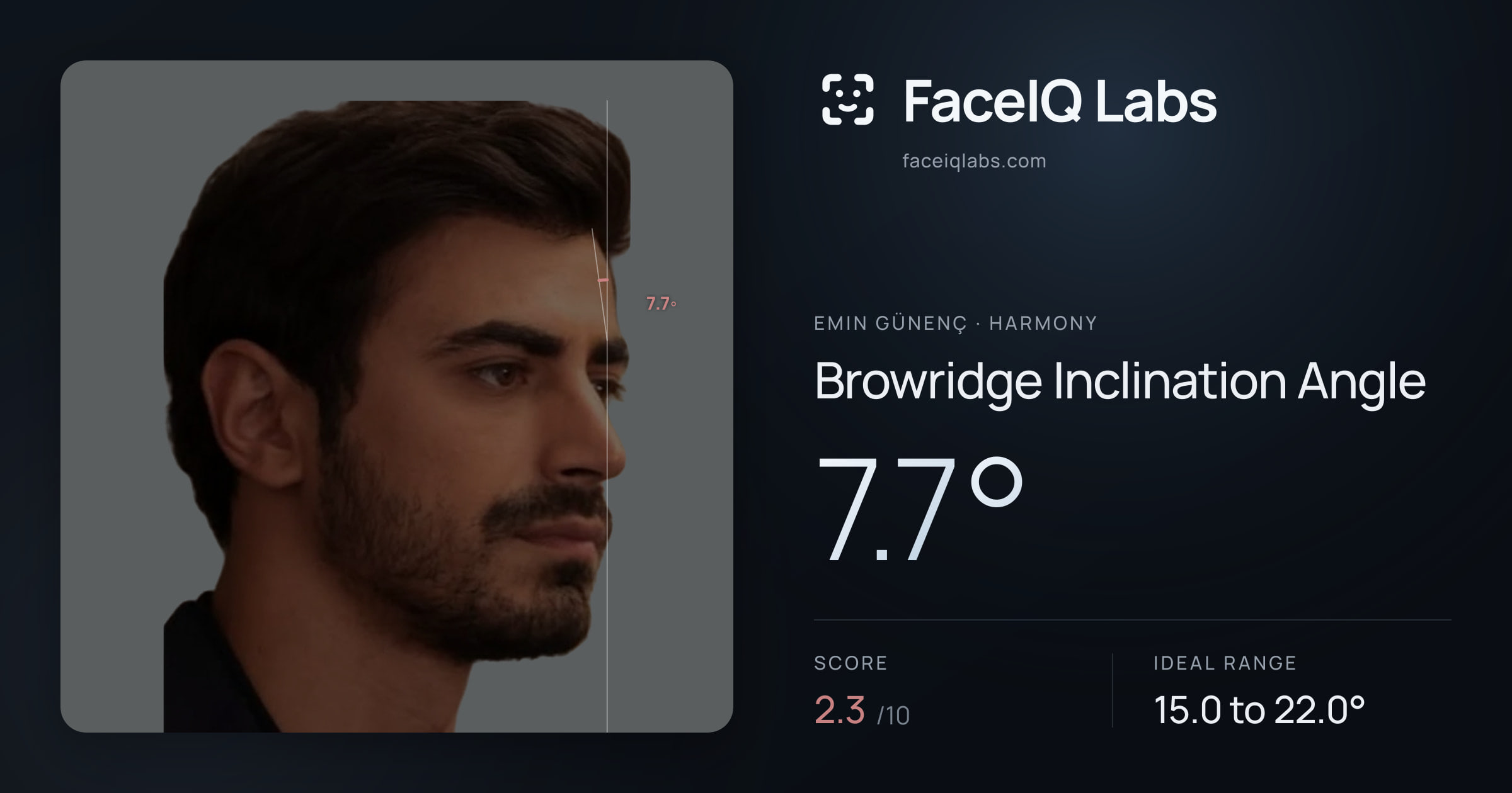 Emin Günenç Browridge Inclination Angle: 7.7°, drawn on the photo