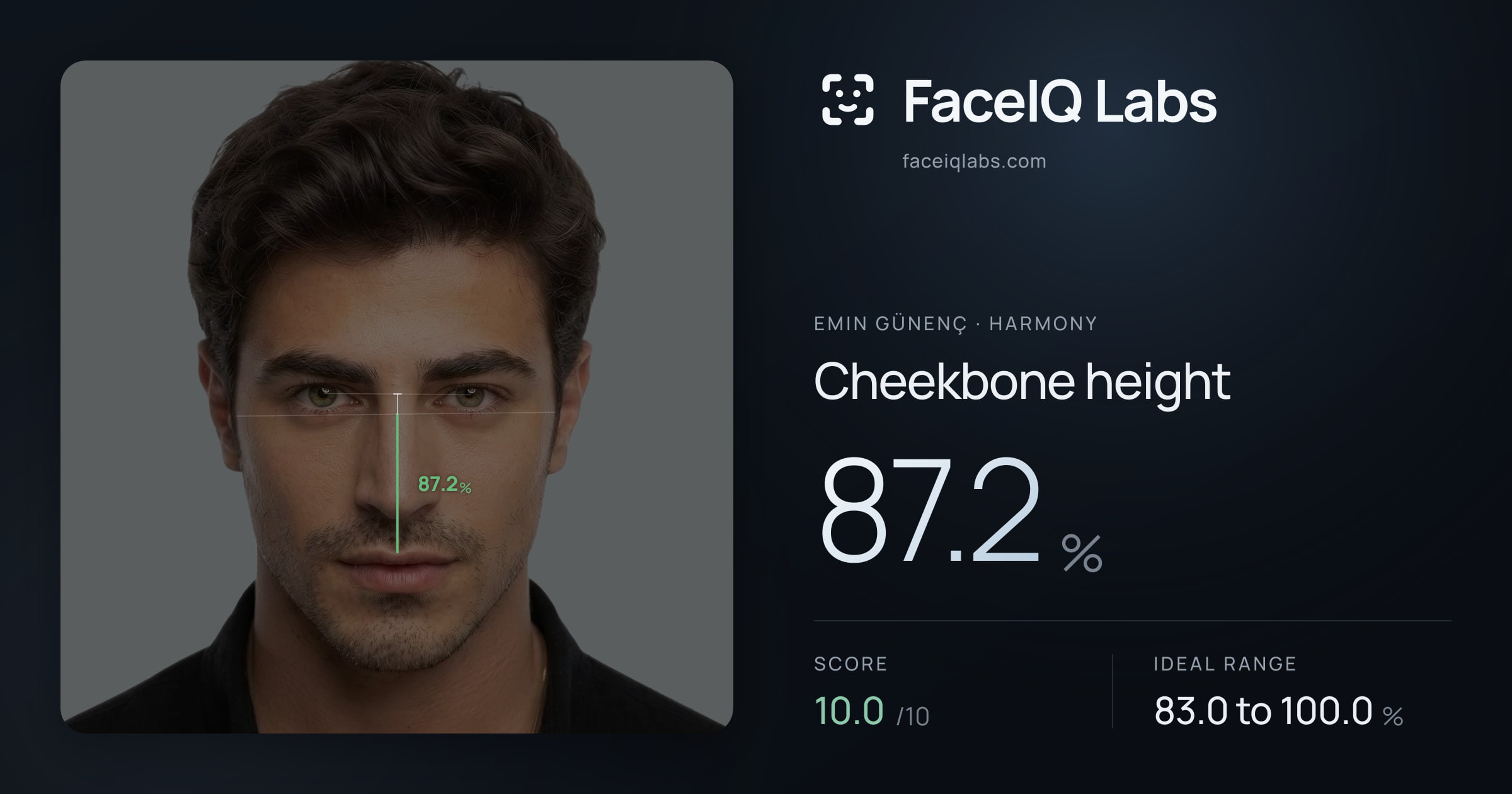 Emin Günenç Cheekbone height: 87.2%, drawn on the photo