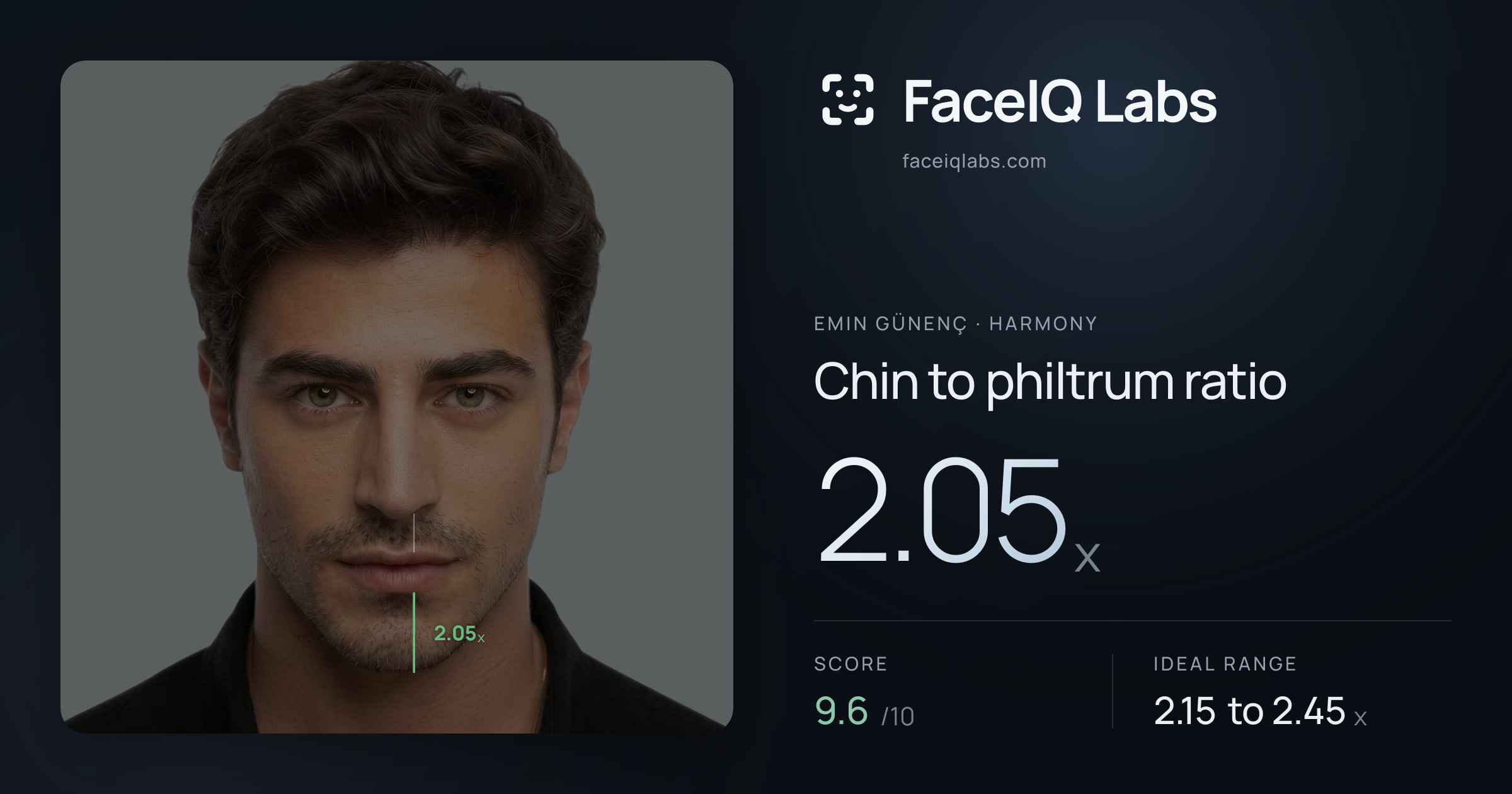 Emin Günenç Chin to philtrum ratio: 2.05x, drawn on the photo