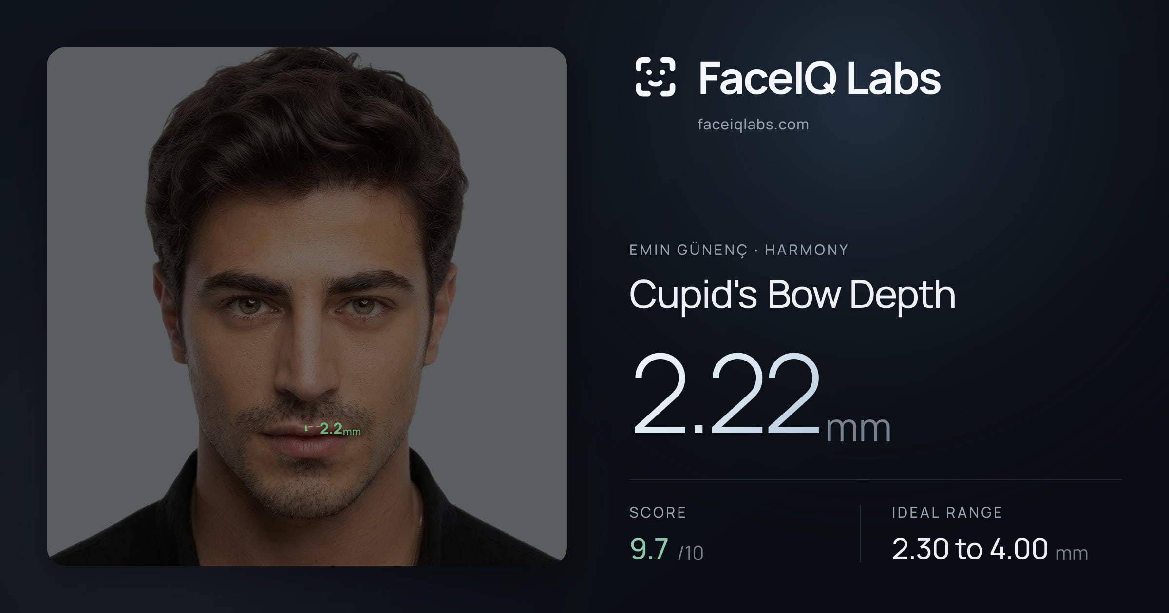 Emin Günenç Cupid's Bow Depth: 2.22mm, drawn on the photo