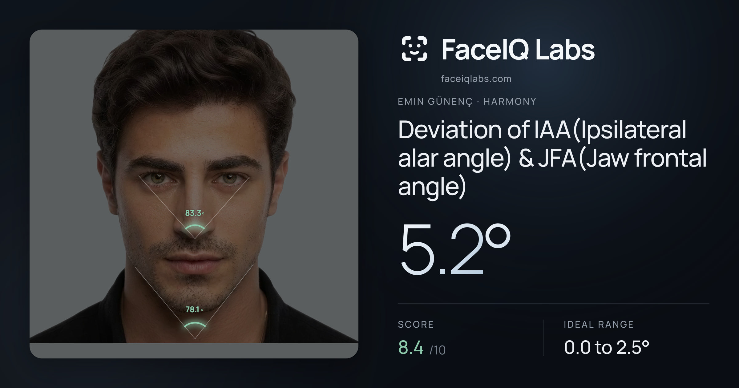 Emin Günenç Deviation of IAA(Ipsilateral alar angle) & JFA(Jaw frontal angle): 5.2°, drawn on the photo