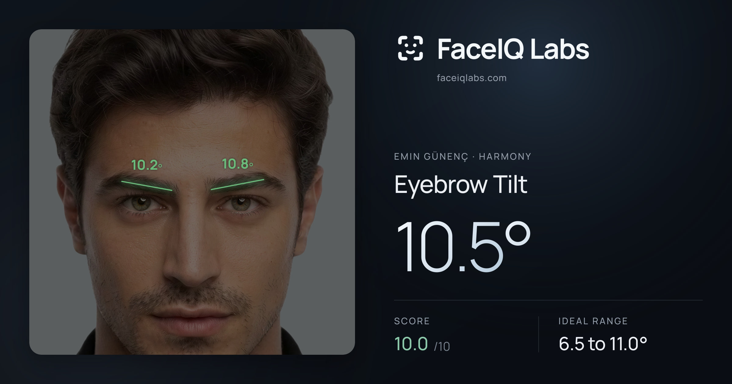 Emin Günenç Eyebrow Tilt: 10.5°, drawn on the photo