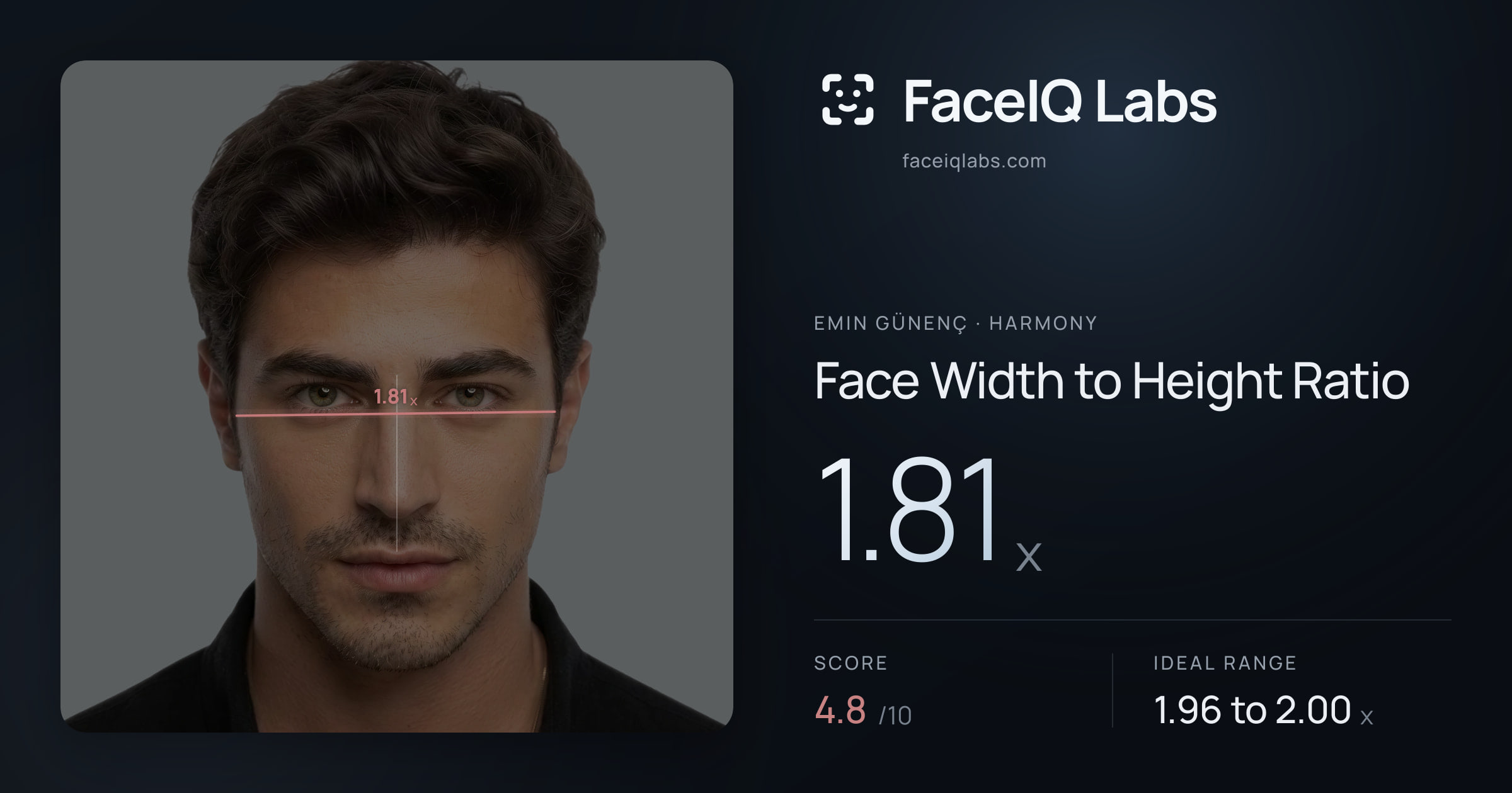 Emin Günenç Face Width to Height Ratio: 1.81x, drawn on the photo
