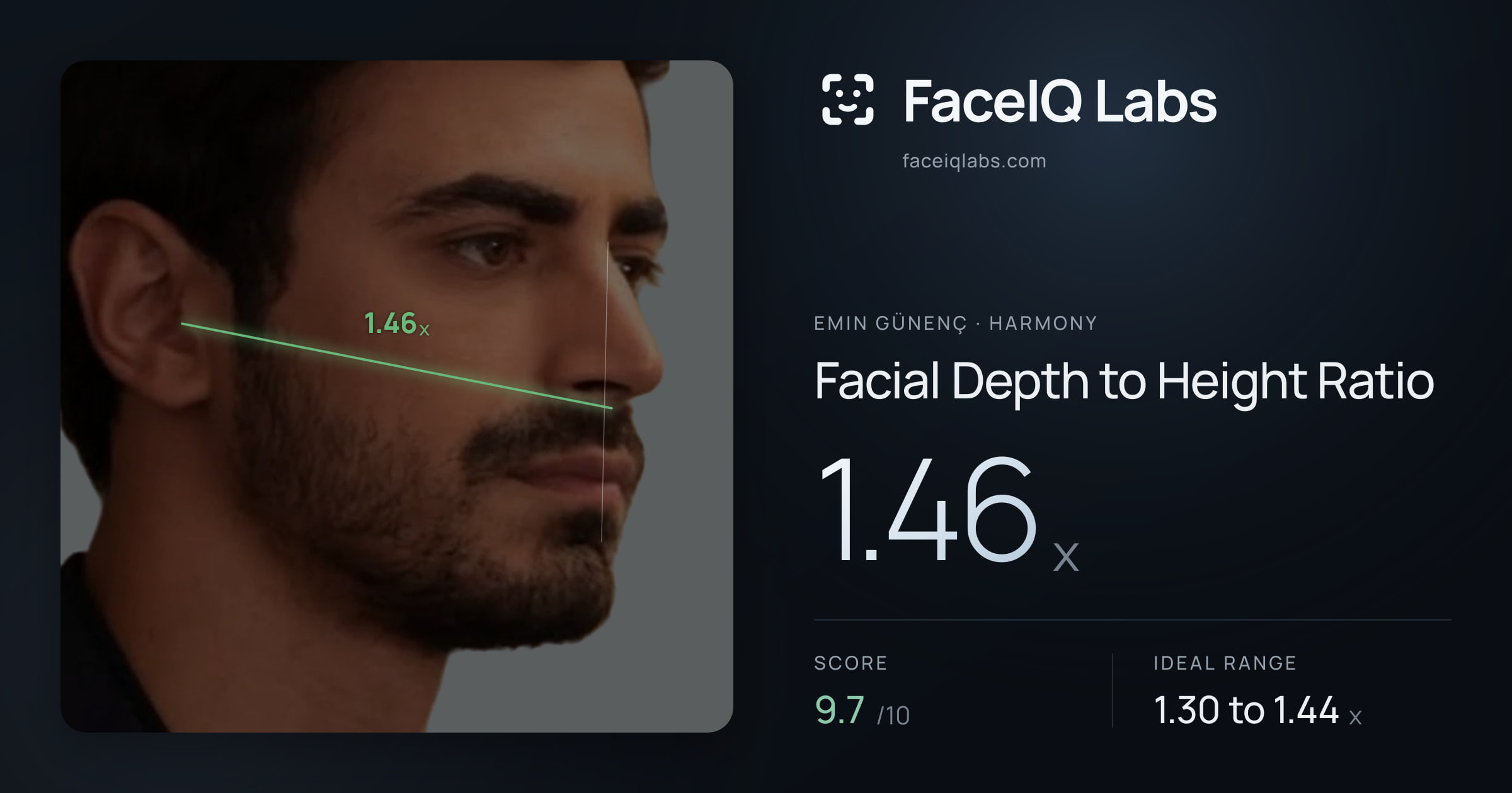 Emin Günenç Facial Depth to Height Ratio: 1.46x, drawn on the photo