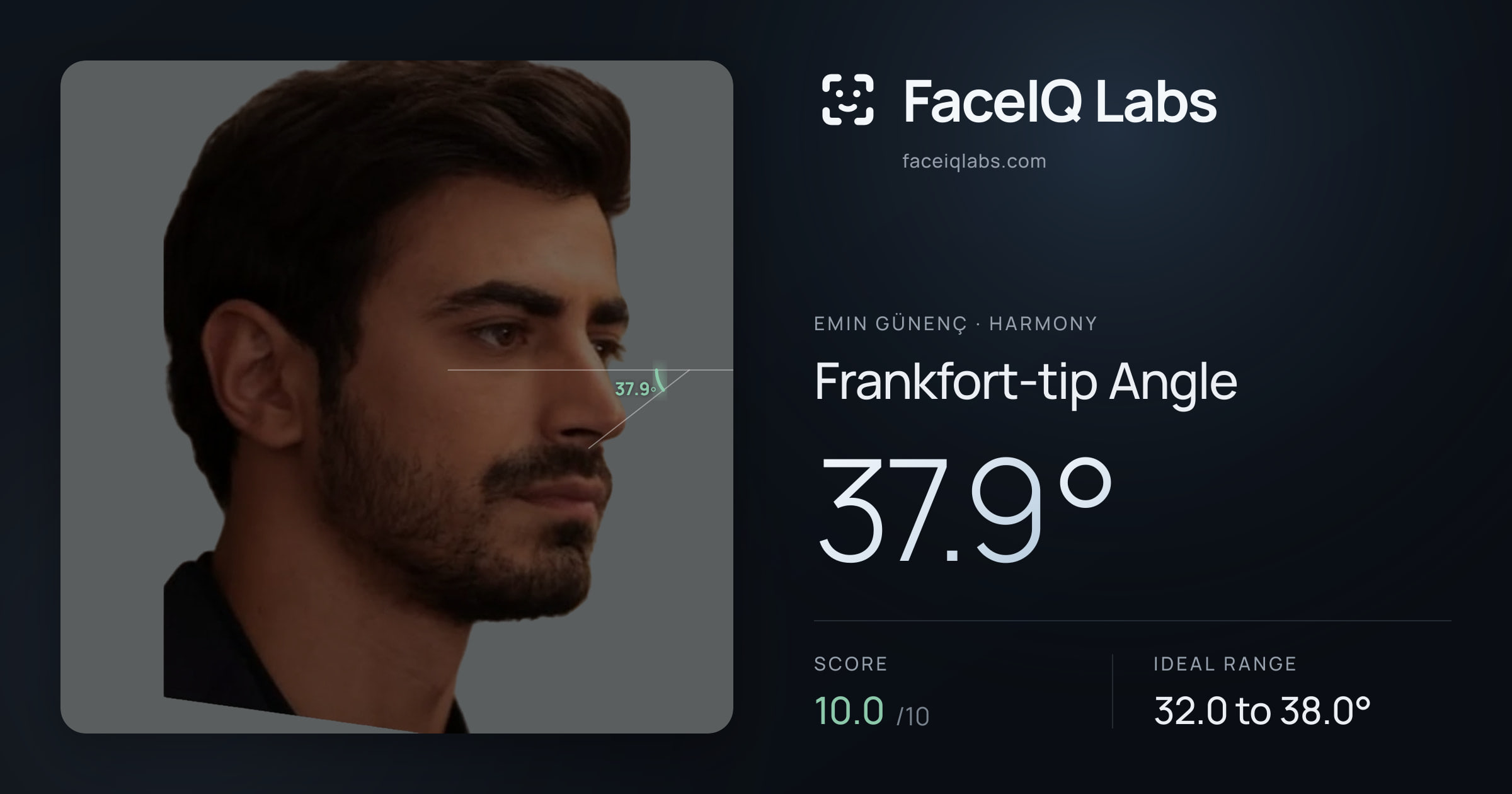 Emin Günenç Frankfort-tip Angle: 37.9°, drawn on the photo